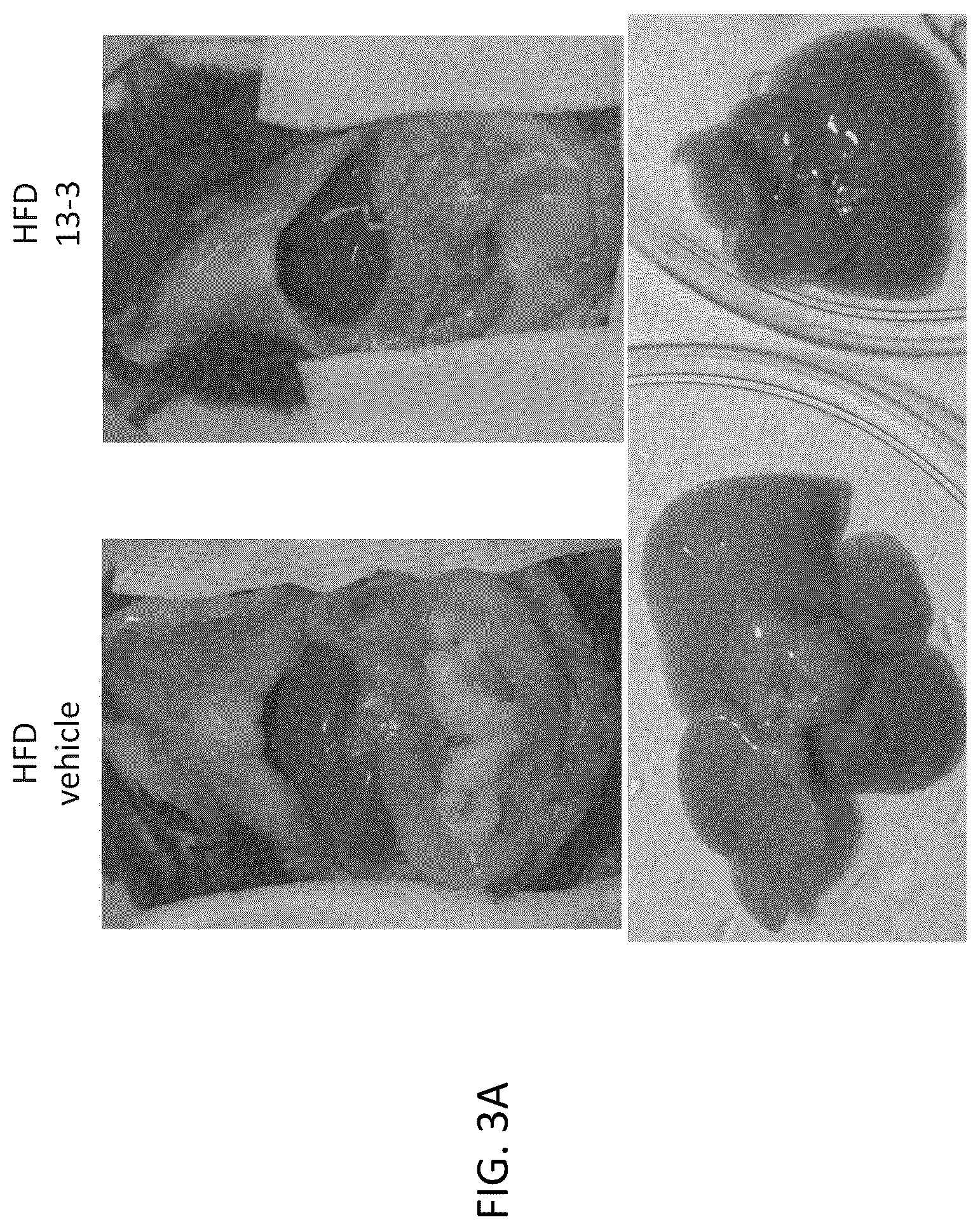 Patent US12318381 Figure 6 – Treatment for non-alcoholic fatty liver disease