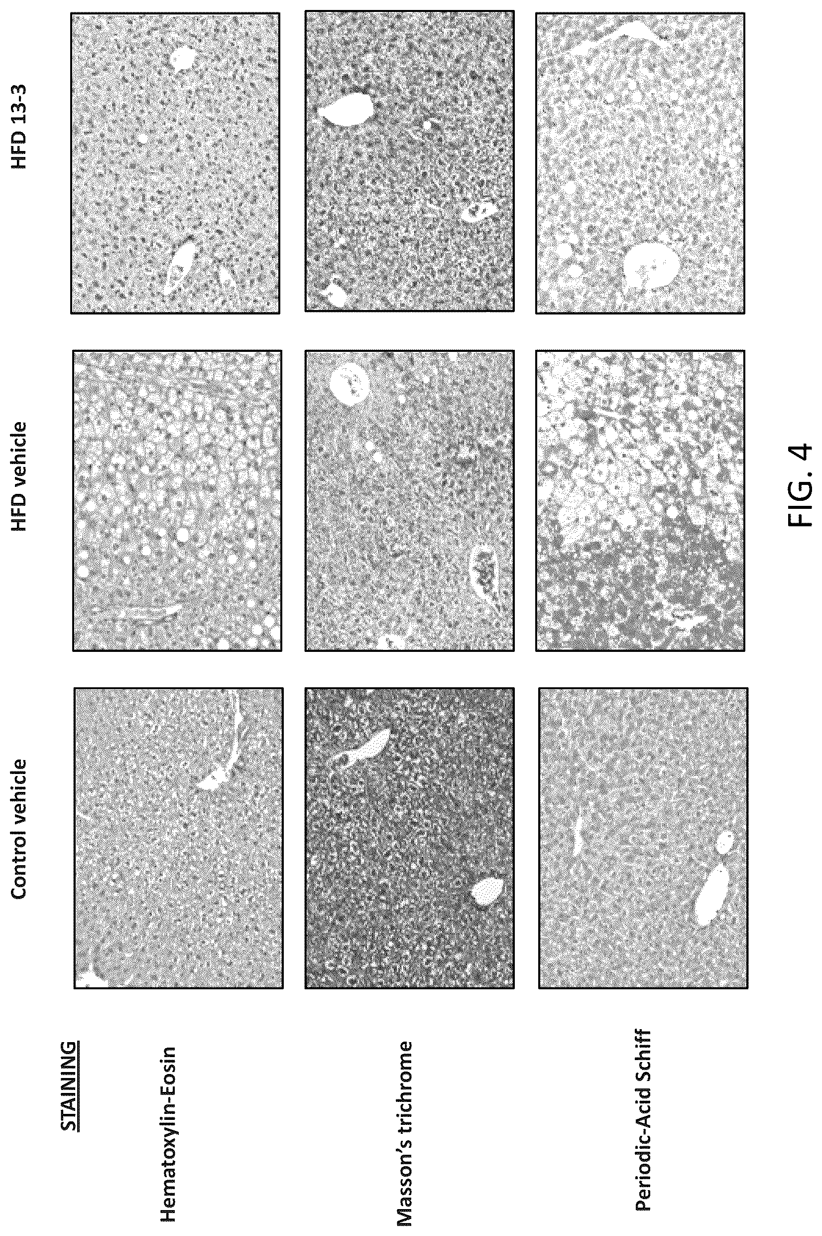 Patent US12318381 Figure 8 – Treatment for non-alcoholic fatty liver disease
