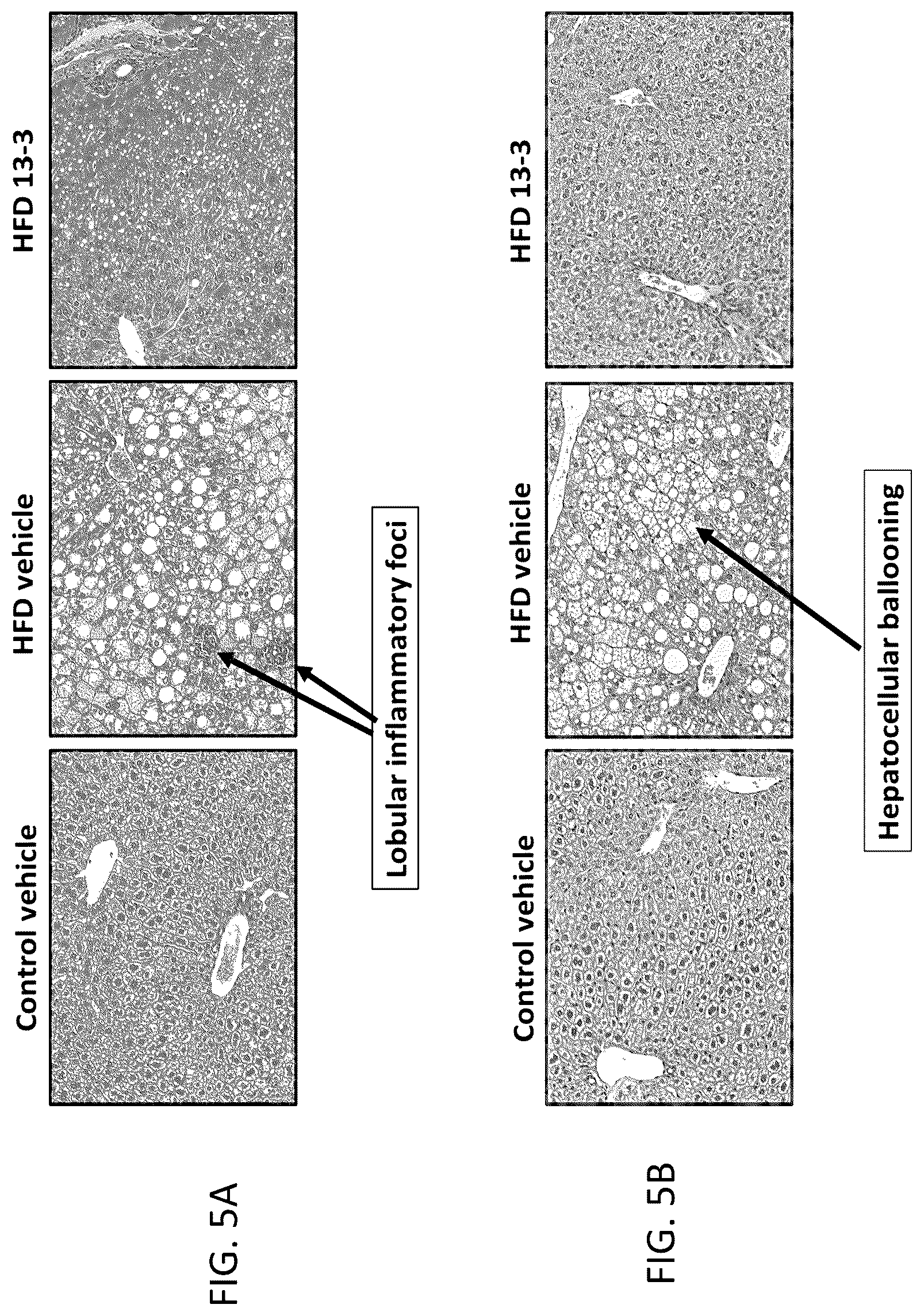 Patent US12318381 Figure 9 – Treatment for non-alcoholic fatty liver disease