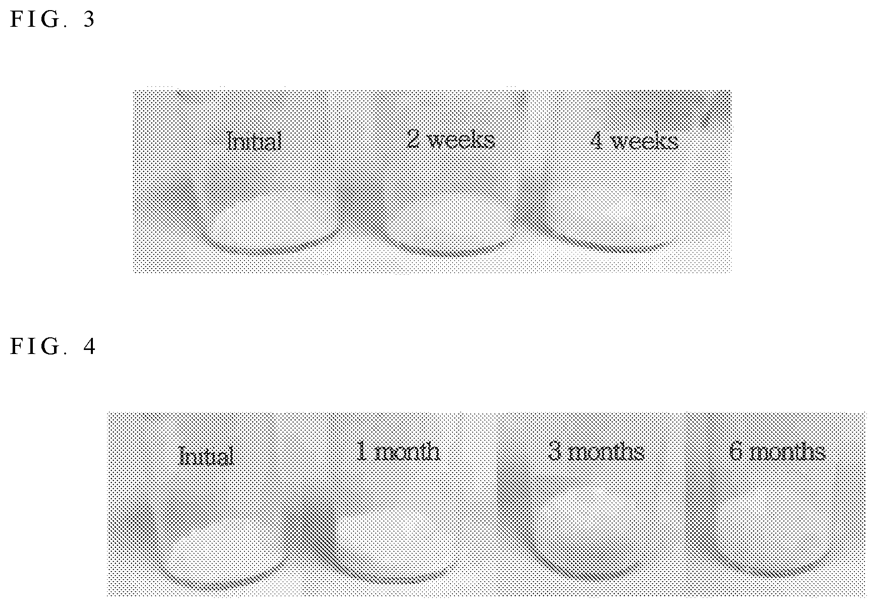 Patent US12318390 Figure 3 – Pharmaceutical composition for oral administration comprising aminopyrimidine derivative or its salt