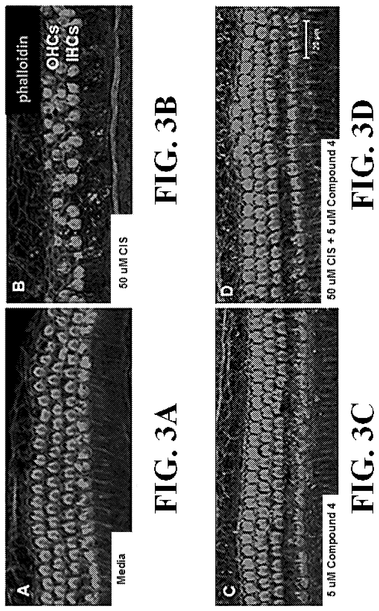 Patent US12318391 Figure 4 – Methods and compositions for the prevention and treatment of hearing loss