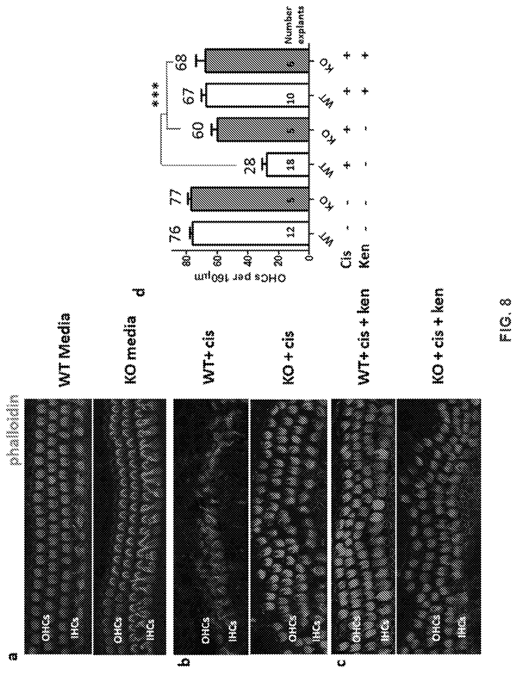 Patent US12318391 Figure 14 – Methods and compositions for the prevention and treatment of hearing loss