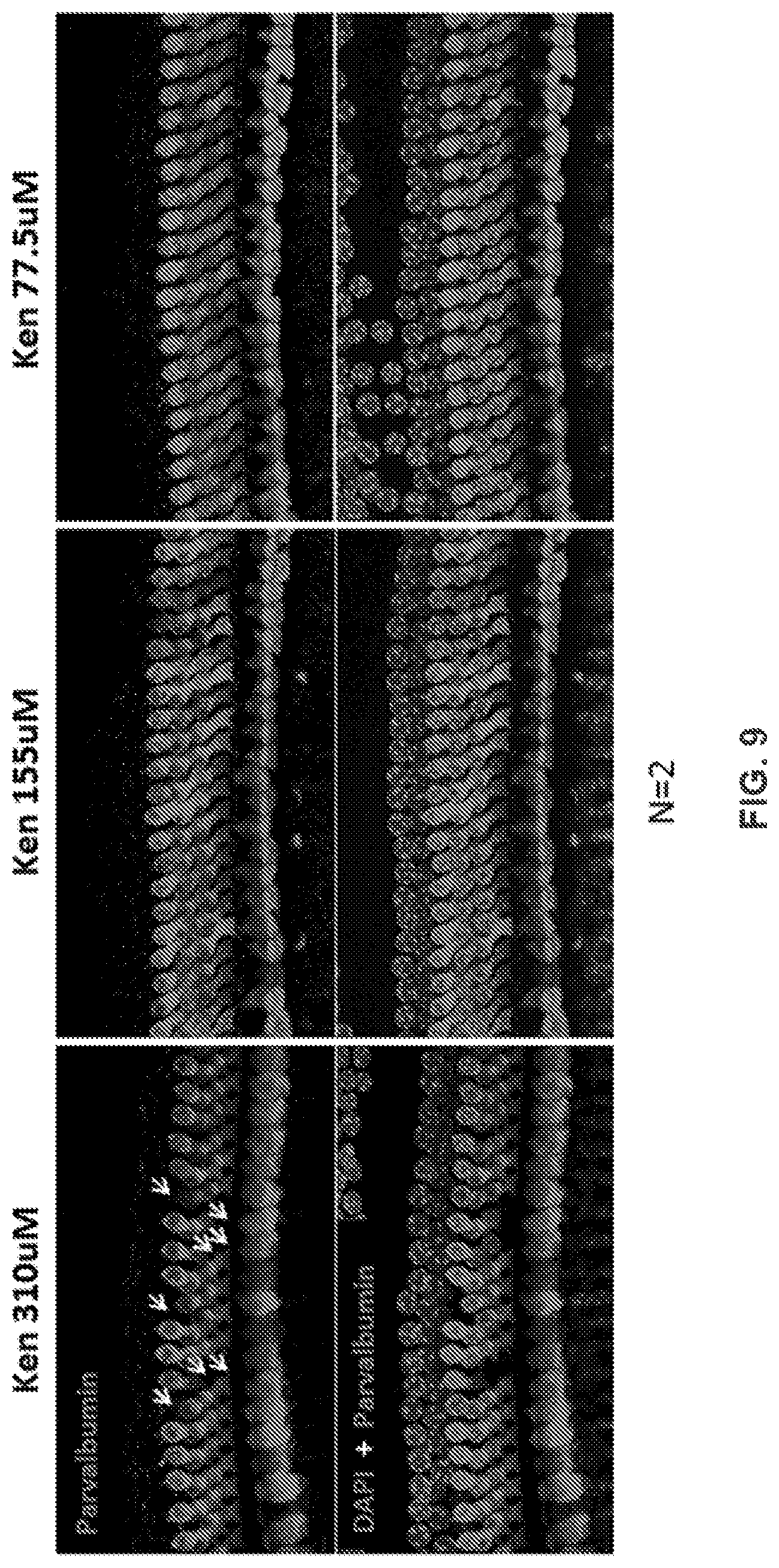 Patent US12318391 Figure 15 – Methods and compositions for the prevention and treatment of hearing loss