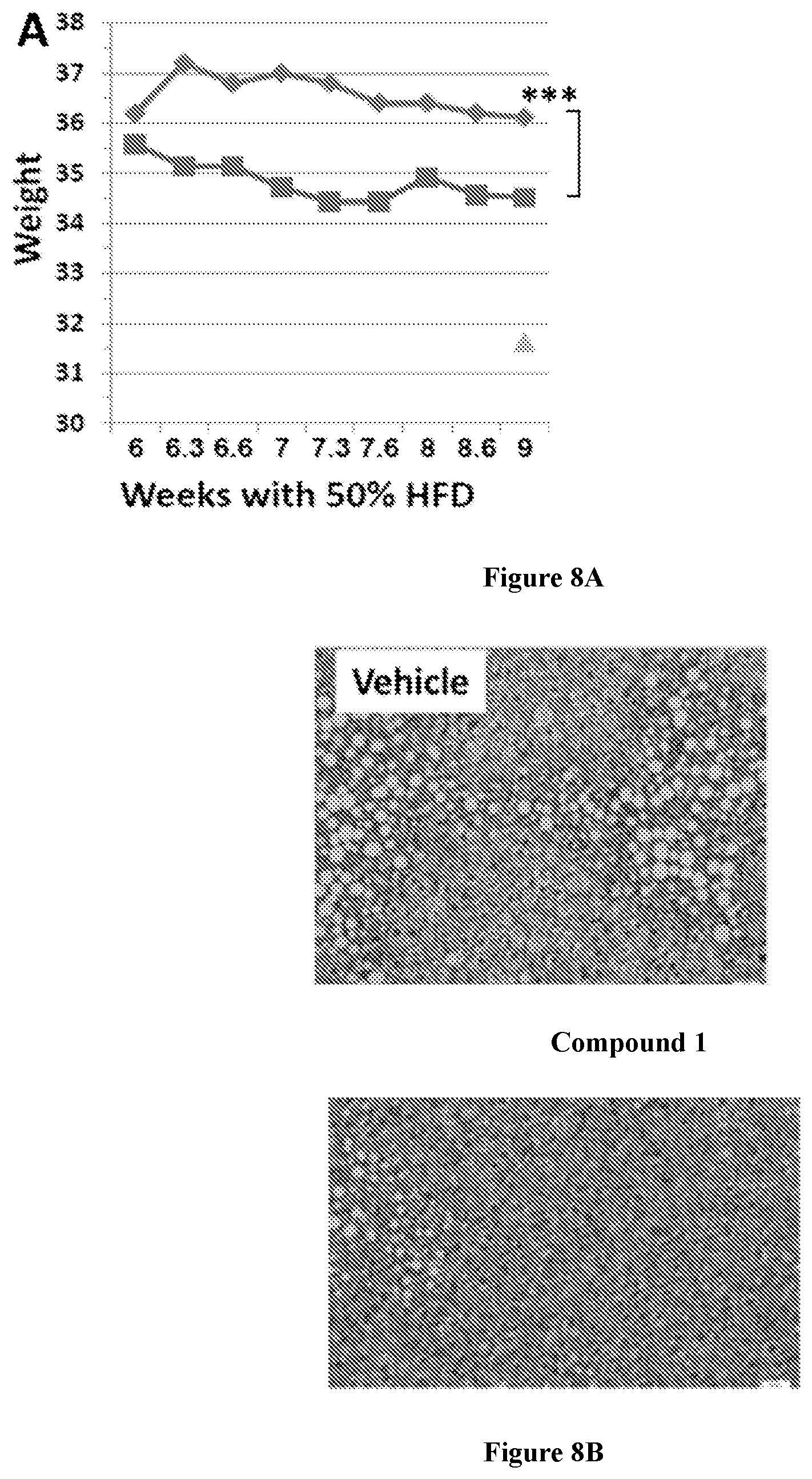Patent US12318393 Figure 11 – Modulators of orphan nuclear receptors for NASH and other metabolic disorders