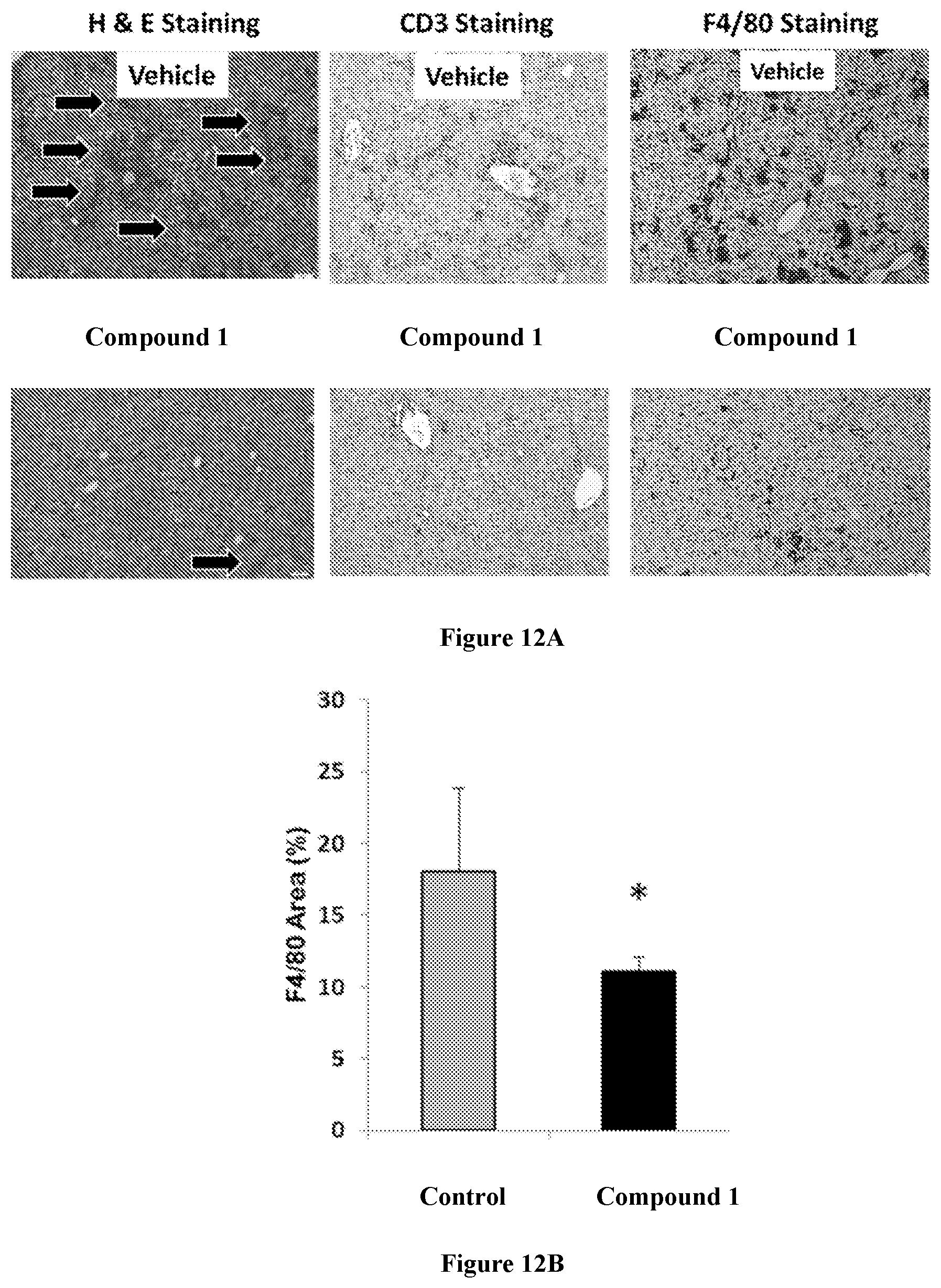 Patent US12318393 Figure 17 – Modulators of orphan nuclear receptors for NASH and other metabolic disorders