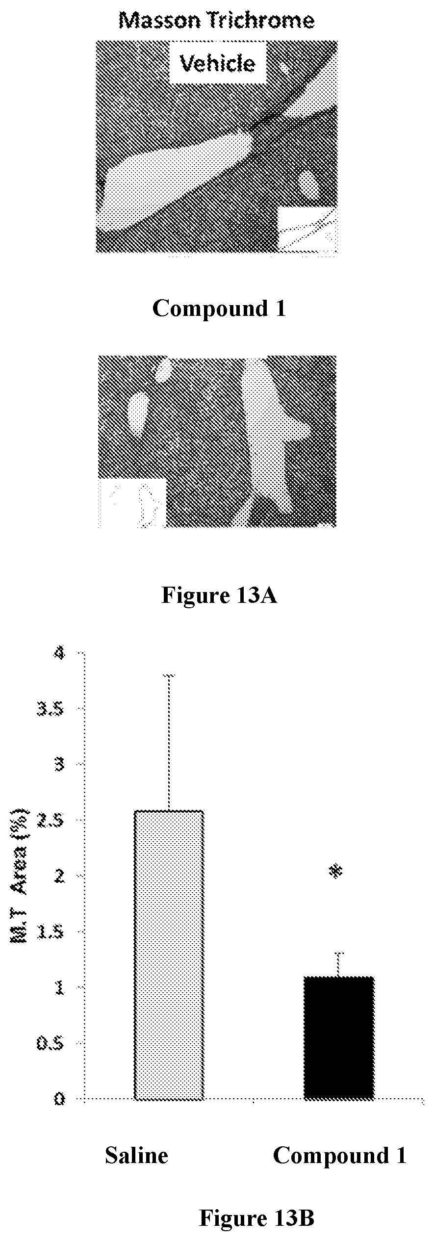 Patent US12318393 Figure 18 – Modulators of orphan nuclear receptors for NASH and other metabolic disorders