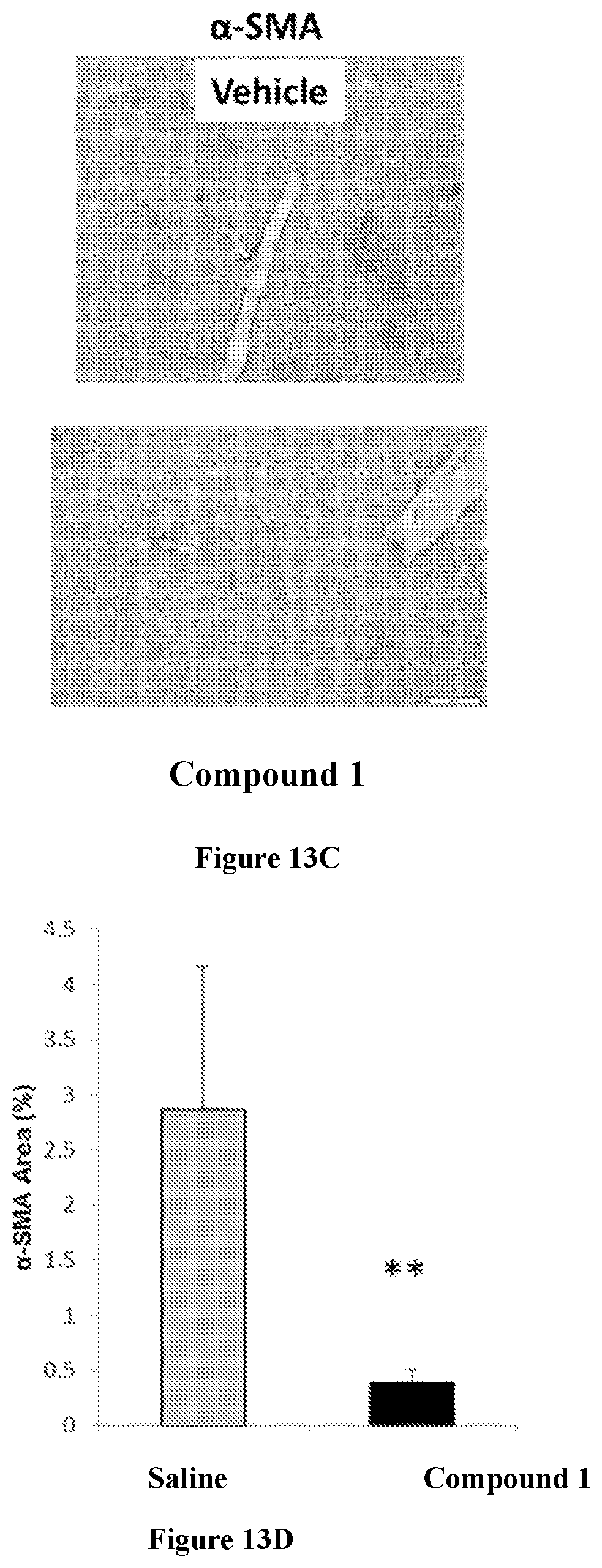 Patent US12318393 Figure 19 – Modulators of orphan nuclear receptors for NASH and other metabolic disorders