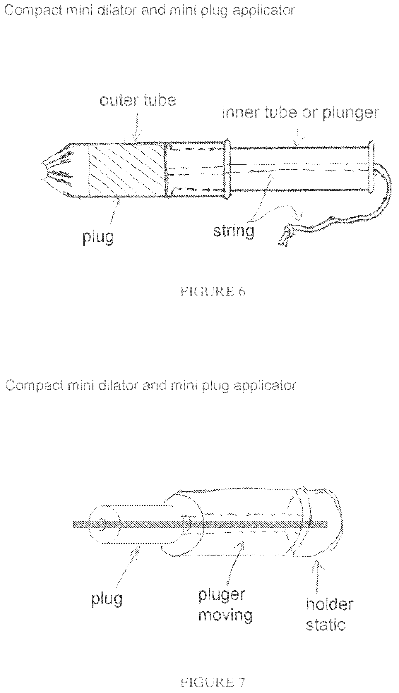 Patent US12318394 Figure 6 – Devices and methods for delivering a bio-active agent or bio-active agents
