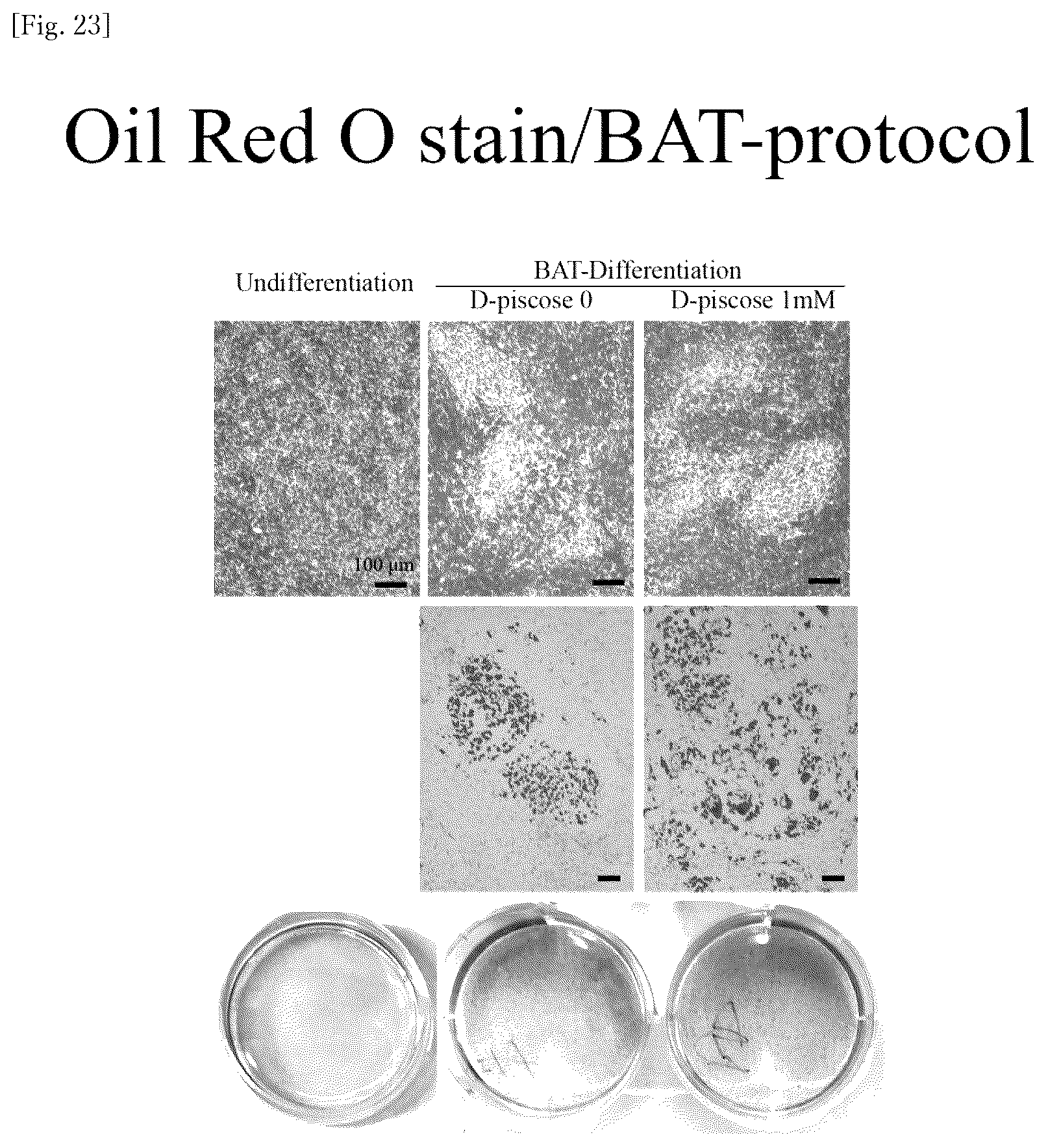 Patent US12318400 Figure 14 – Brown and beige adipocyte activating agent containing D-allulose as active ingredient