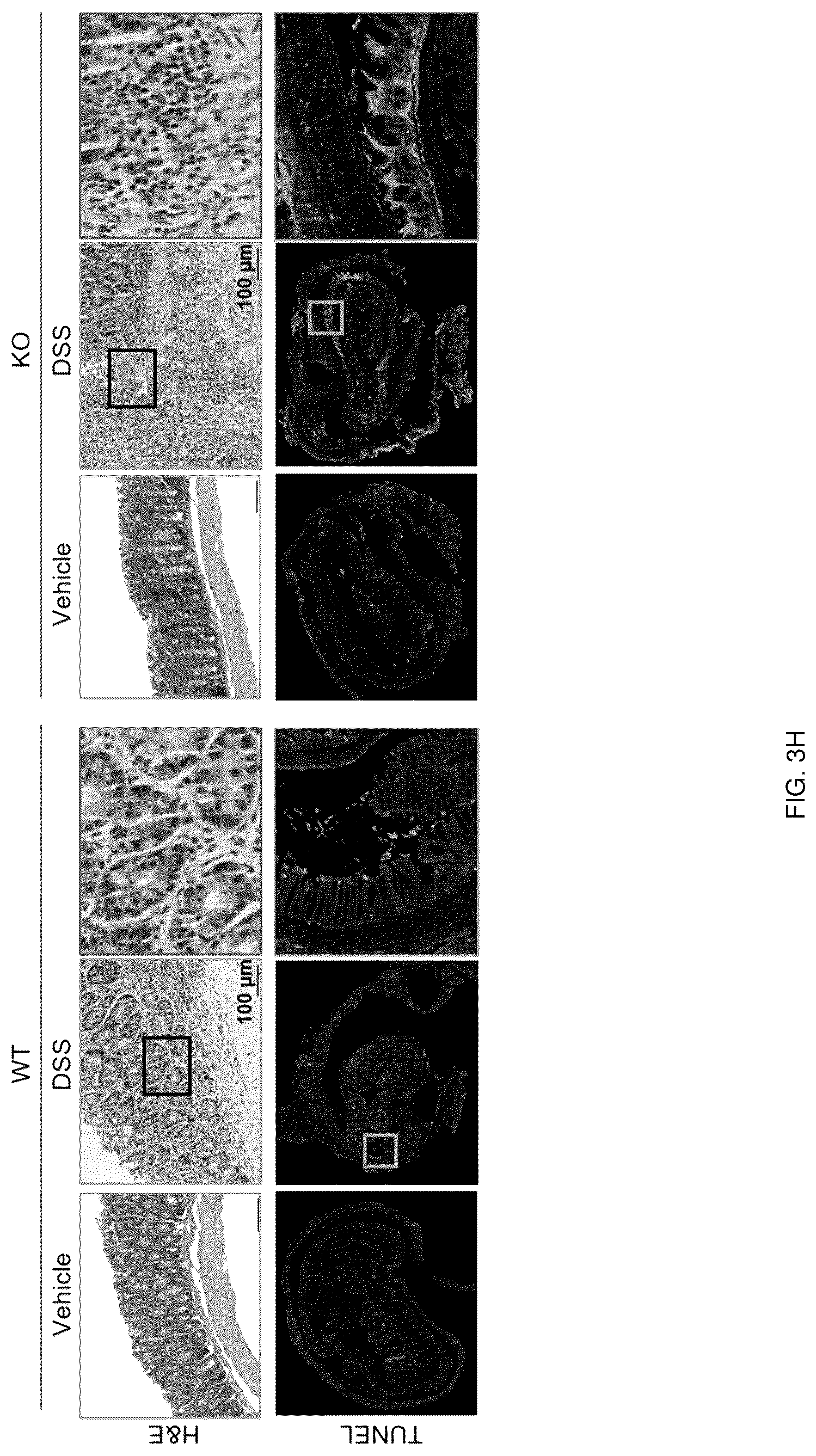 Patent US12318402 Figure 15 – Composition for treating or preventing colitis by NAMPT metabolic regulation