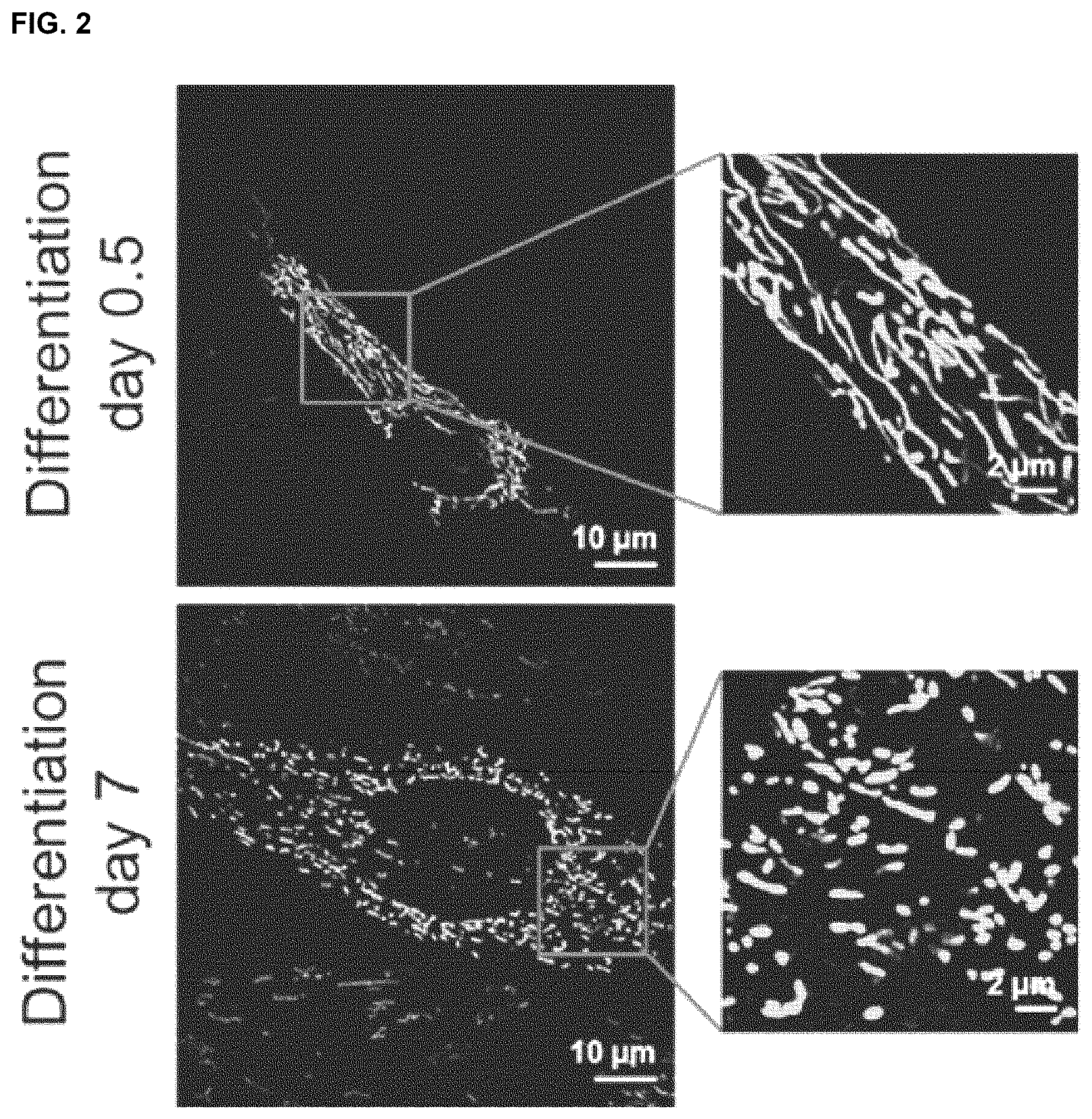 Patent US12318409 Figure 2 – Pharmaceutical composition for promoting osteogenesis, comprising osteoblast-derived mitochondria