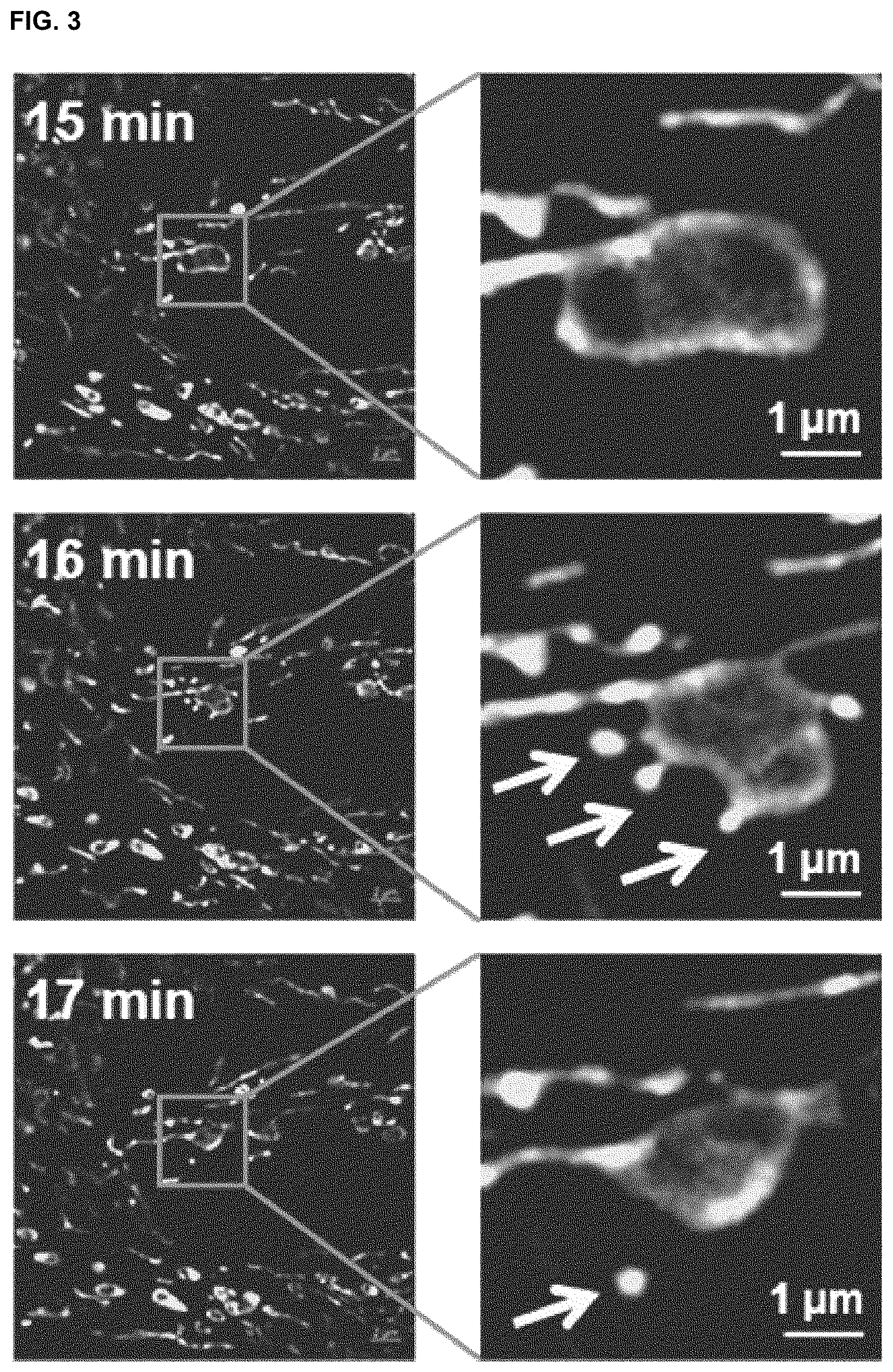 Patent US12318409 Figure 3 – Pharmaceutical composition for promoting osteogenesis, comprising osteoblast-derived mitochondria