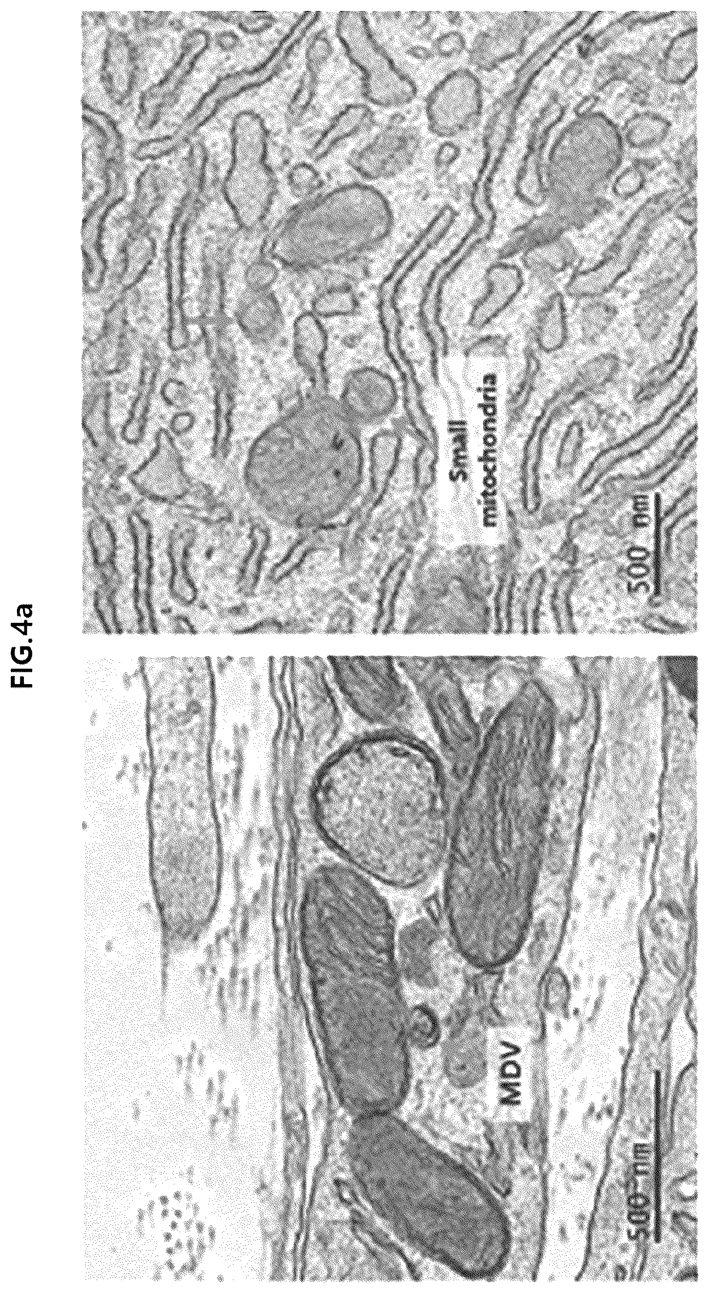 Patent US12318409 Figure 4 – Pharmaceutical composition for promoting osteogenesis, comprising osteoblast-derived mitochondria