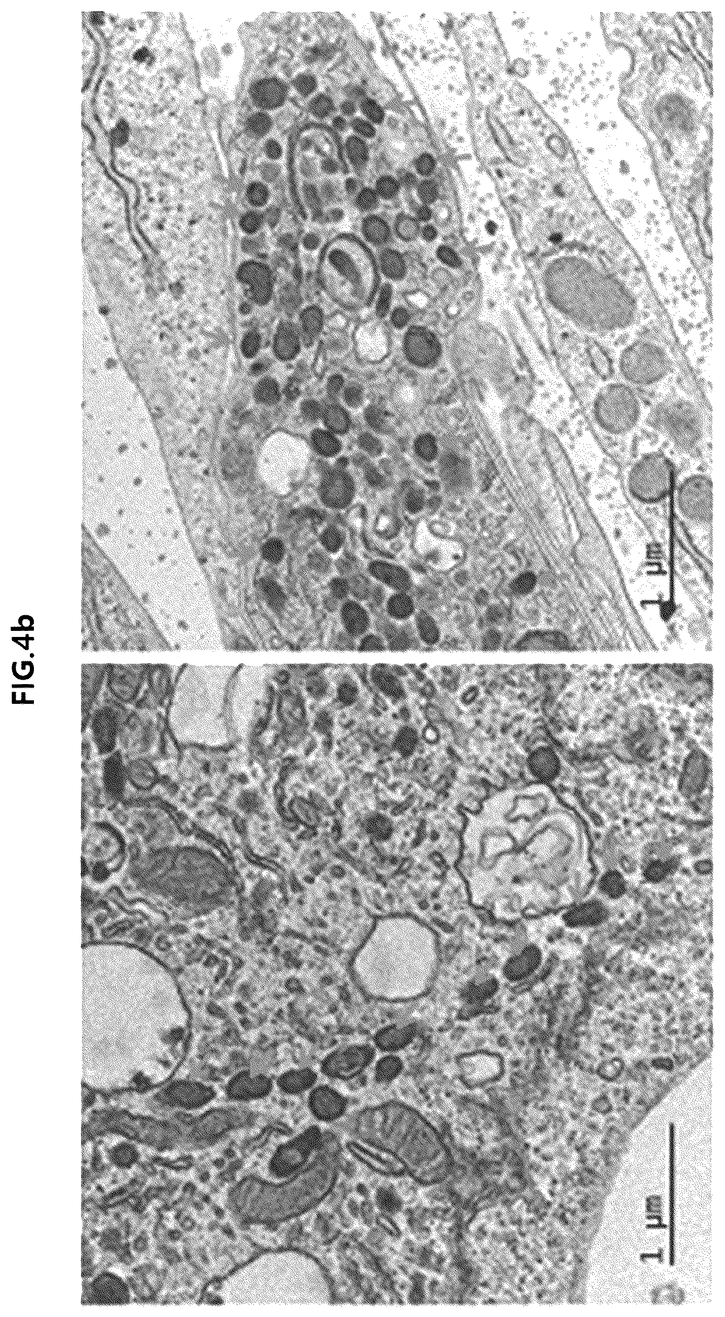 Patent US12318409 Figure 5 – Pharmaceutical composition for promoting osteogenesis, comprising osteoblast-derived mitochondria