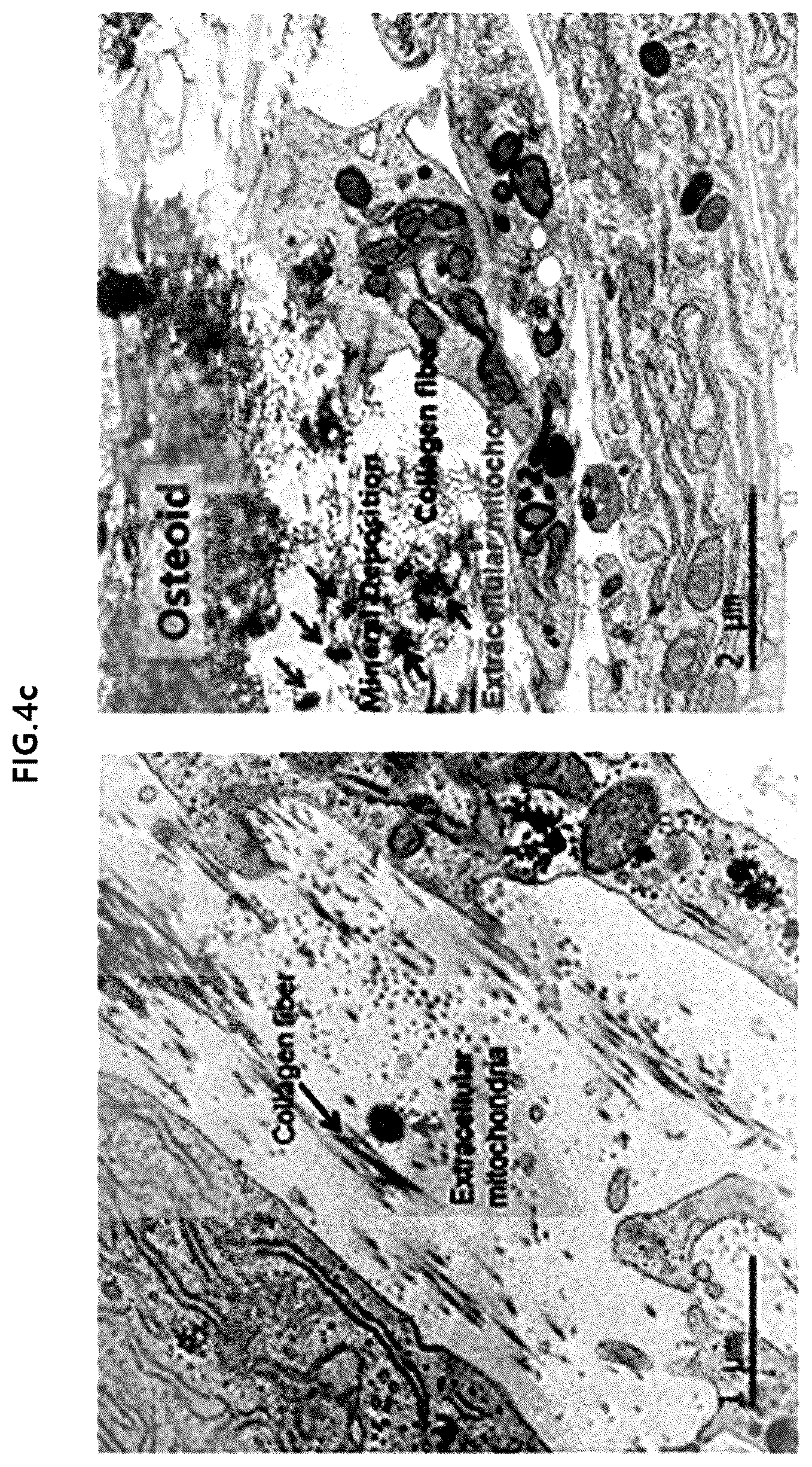 Patent US12318409 Figure 6 – Pharmaceutical composition for promoting osteogenesis, comprising osteoblast-derived mitochondria