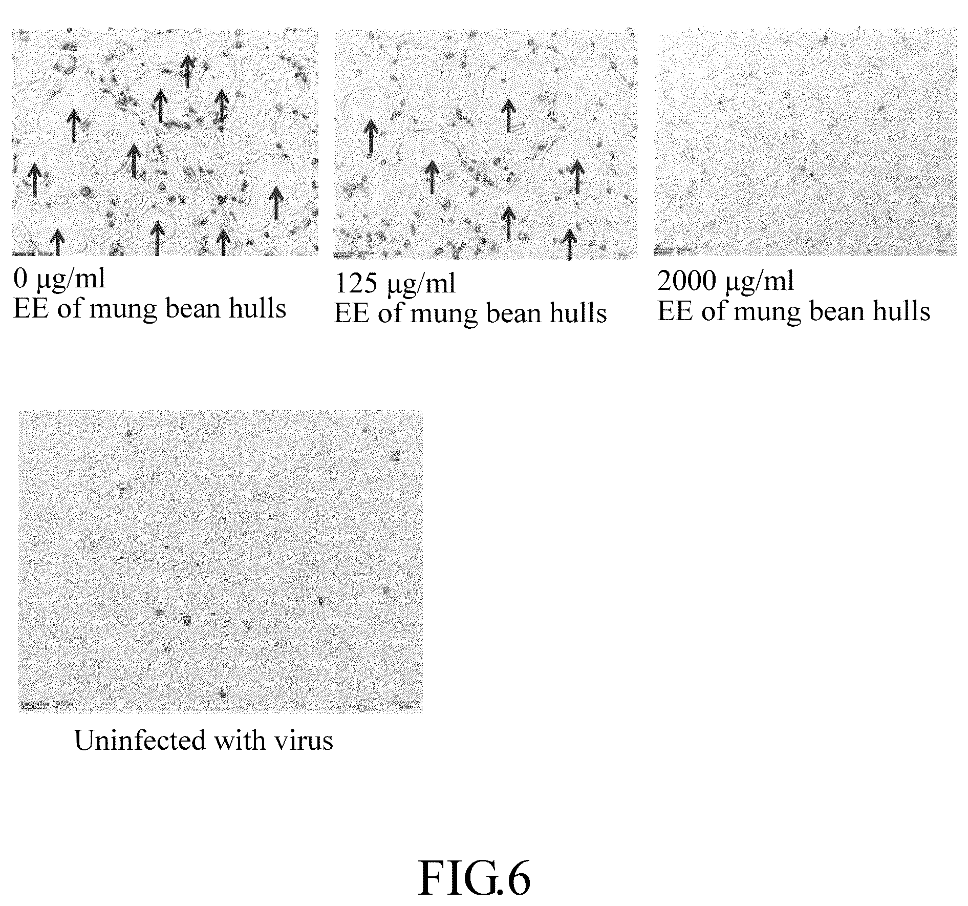 Patent US12318421 Figure 9 – Mung bean hull extract with antiviral effect and extraction method thereof