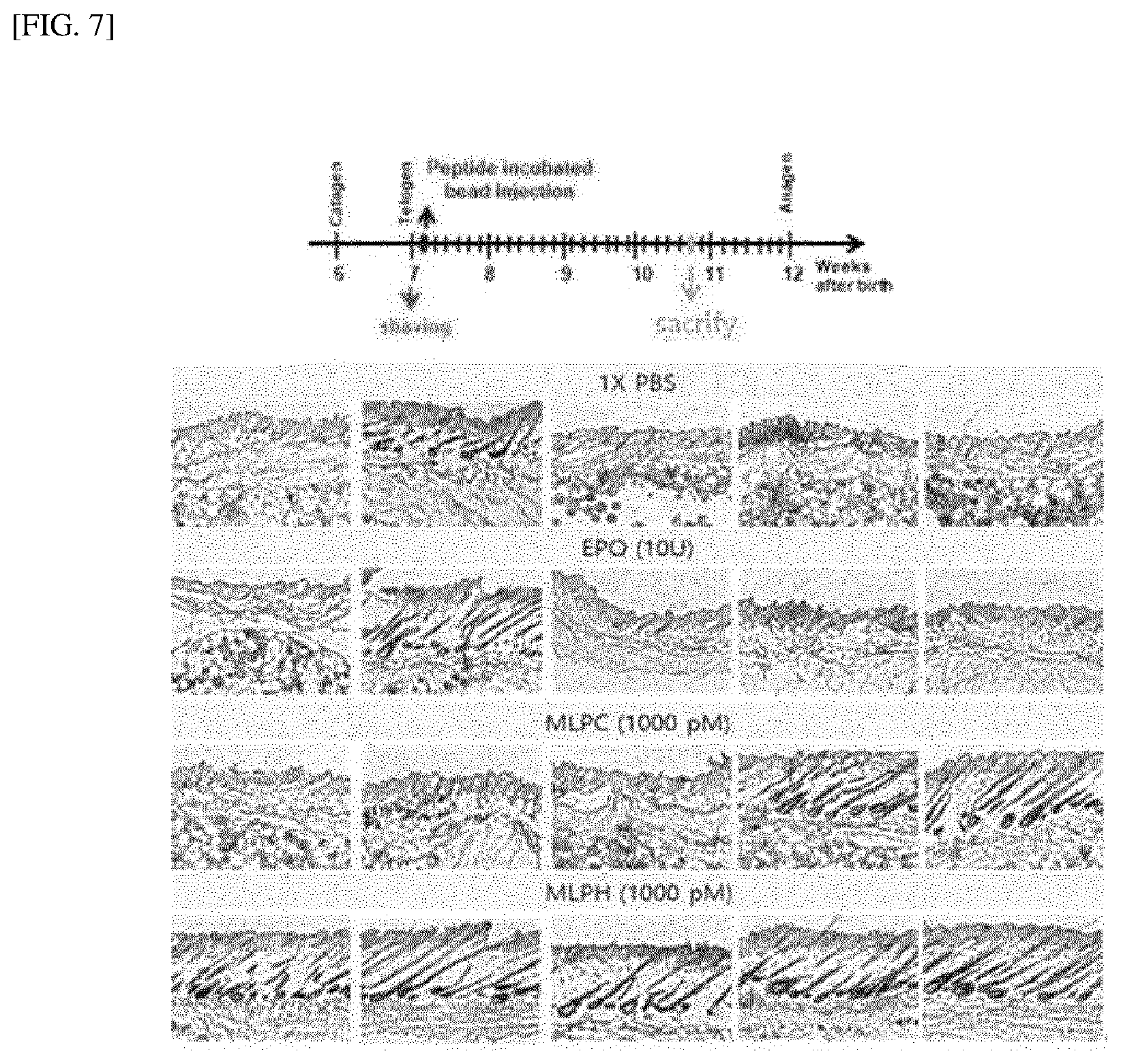 Patent US12318429 Figure 5 – Peptide for preventing or treating hair loss, and use thereof