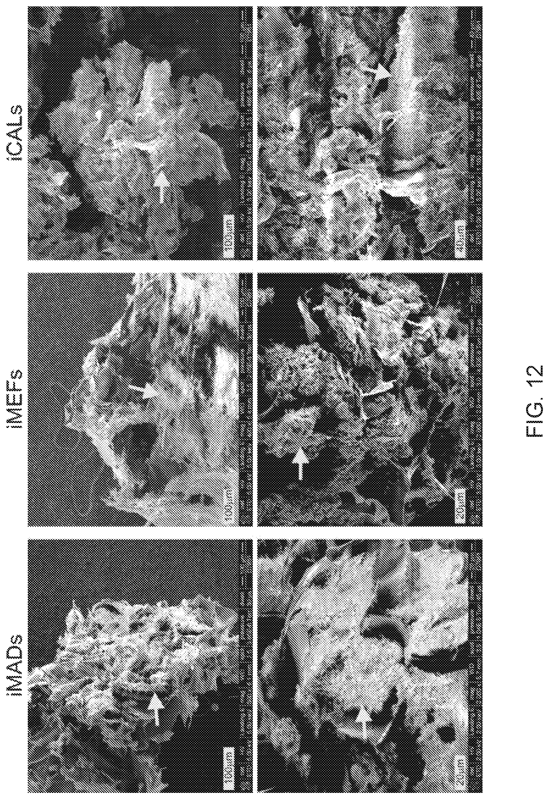 Patent US12318475 Figure 13 – Injectable pastes based on oppositely charged polymer/calcium phosphate nanoparticles