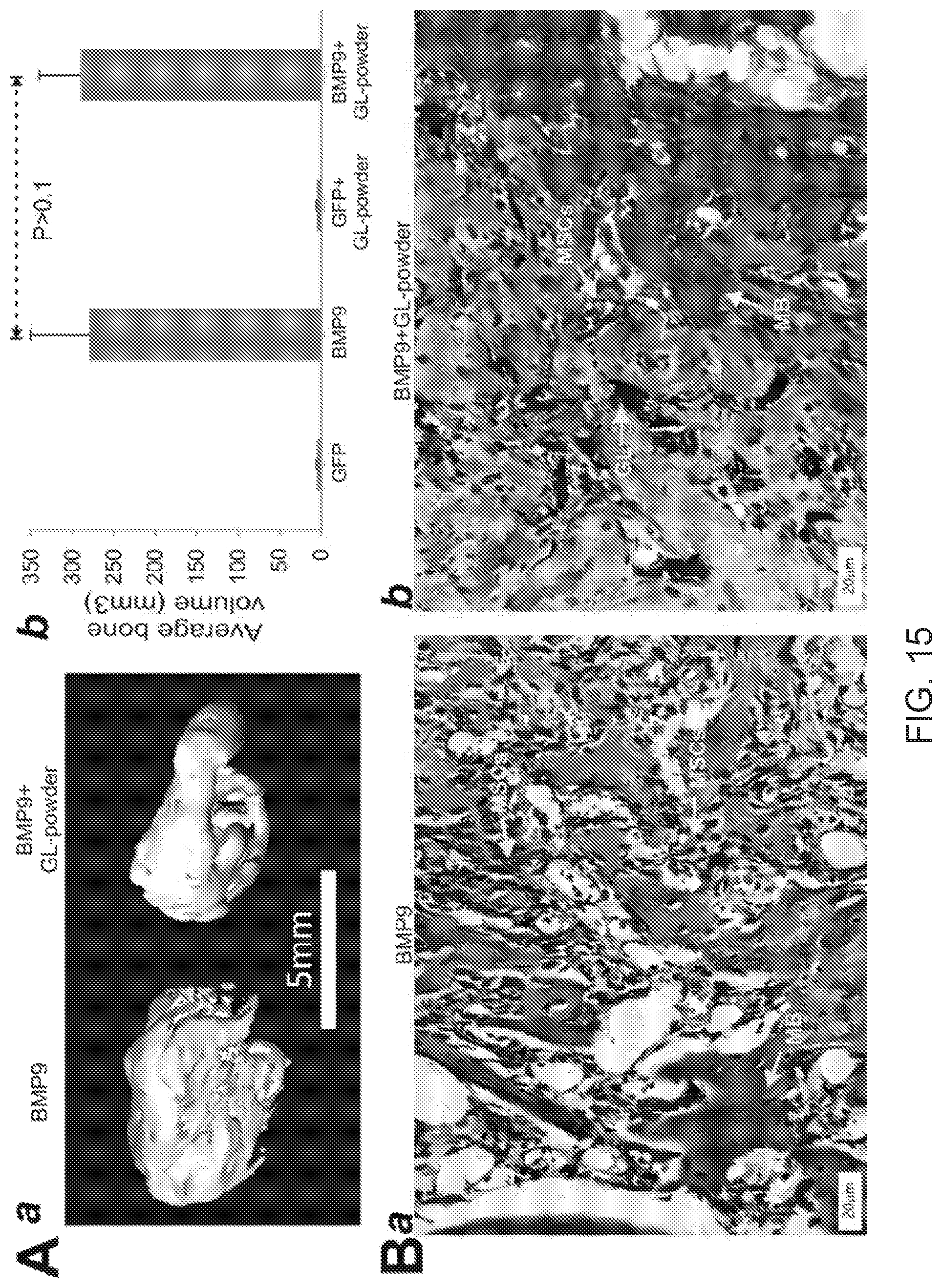 Patent US12318475 Figure 16 – Injectable pastes based on oppositely charged polymer/calcium phosphate nanoparticles