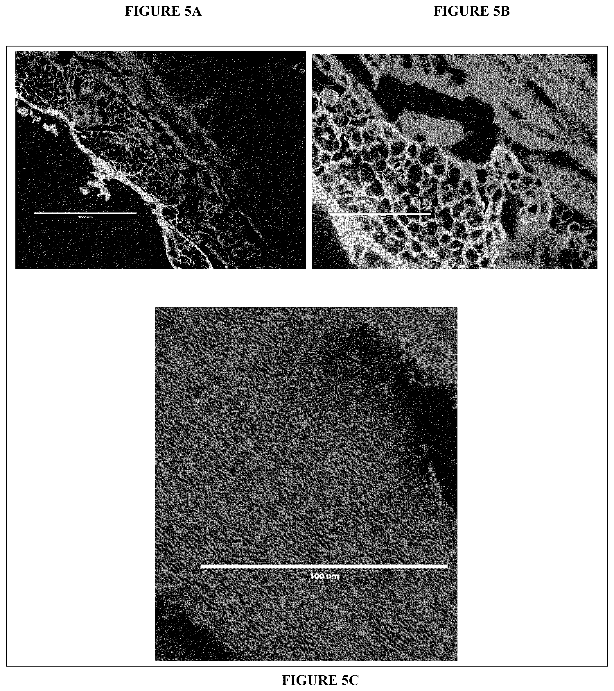 Patent US12318491 Figure 5 – Intraoperative topically-applied non-implantable rapid release patch