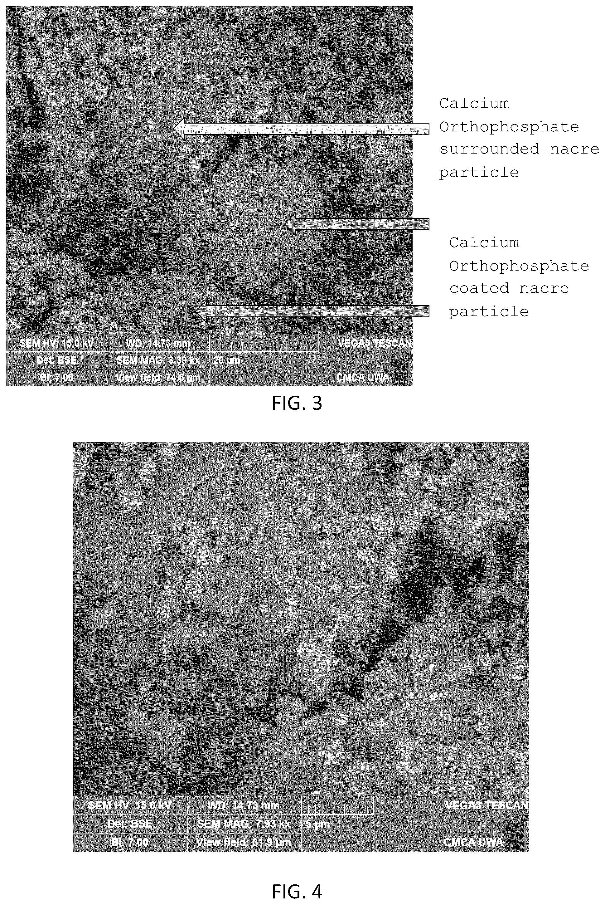 Patent US12318504 Figure 3 – Method for manufacturing a calcified tissue substitute