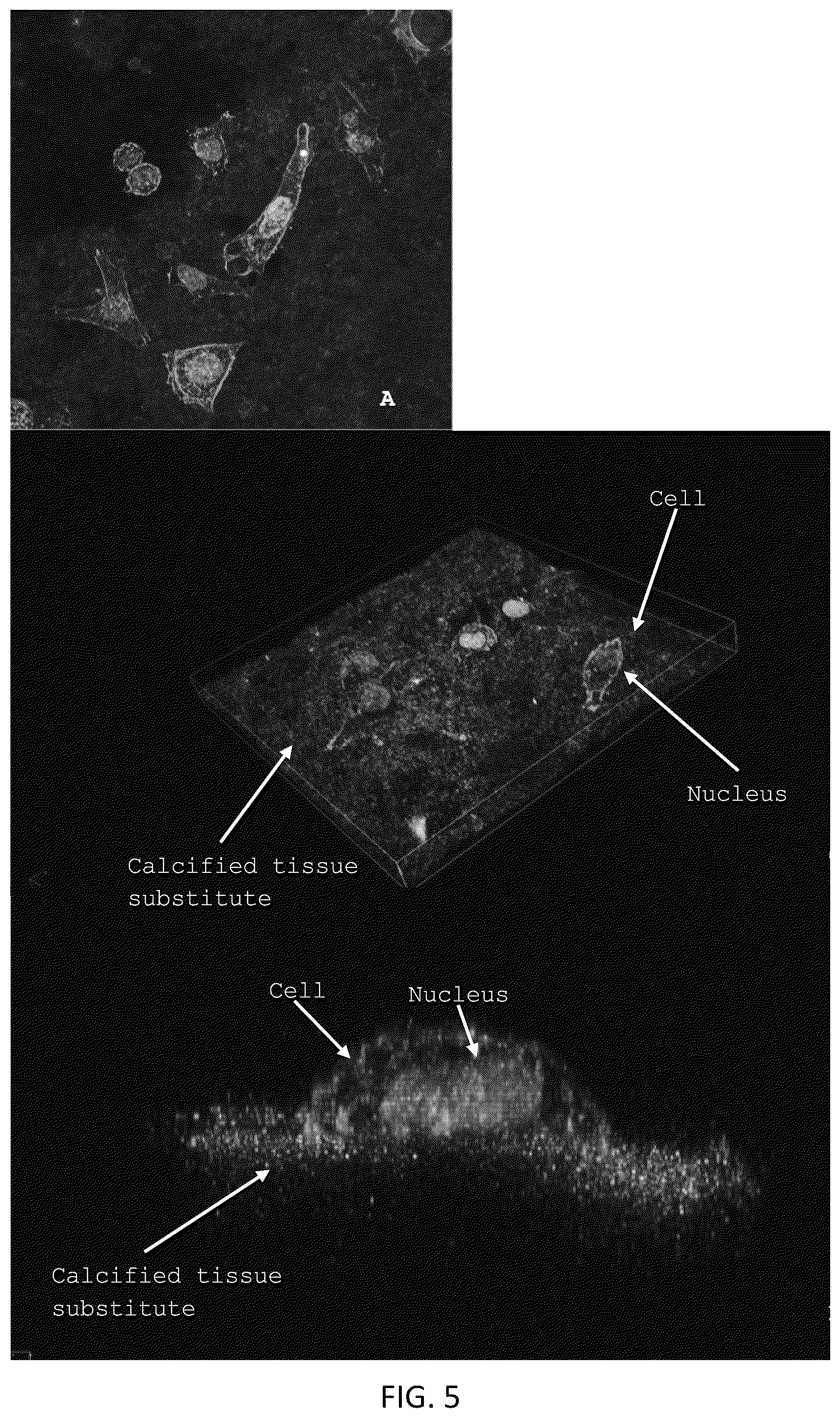 Patent US12318504 Figure 4 – Method for manufacturing a calcified tissue substitute