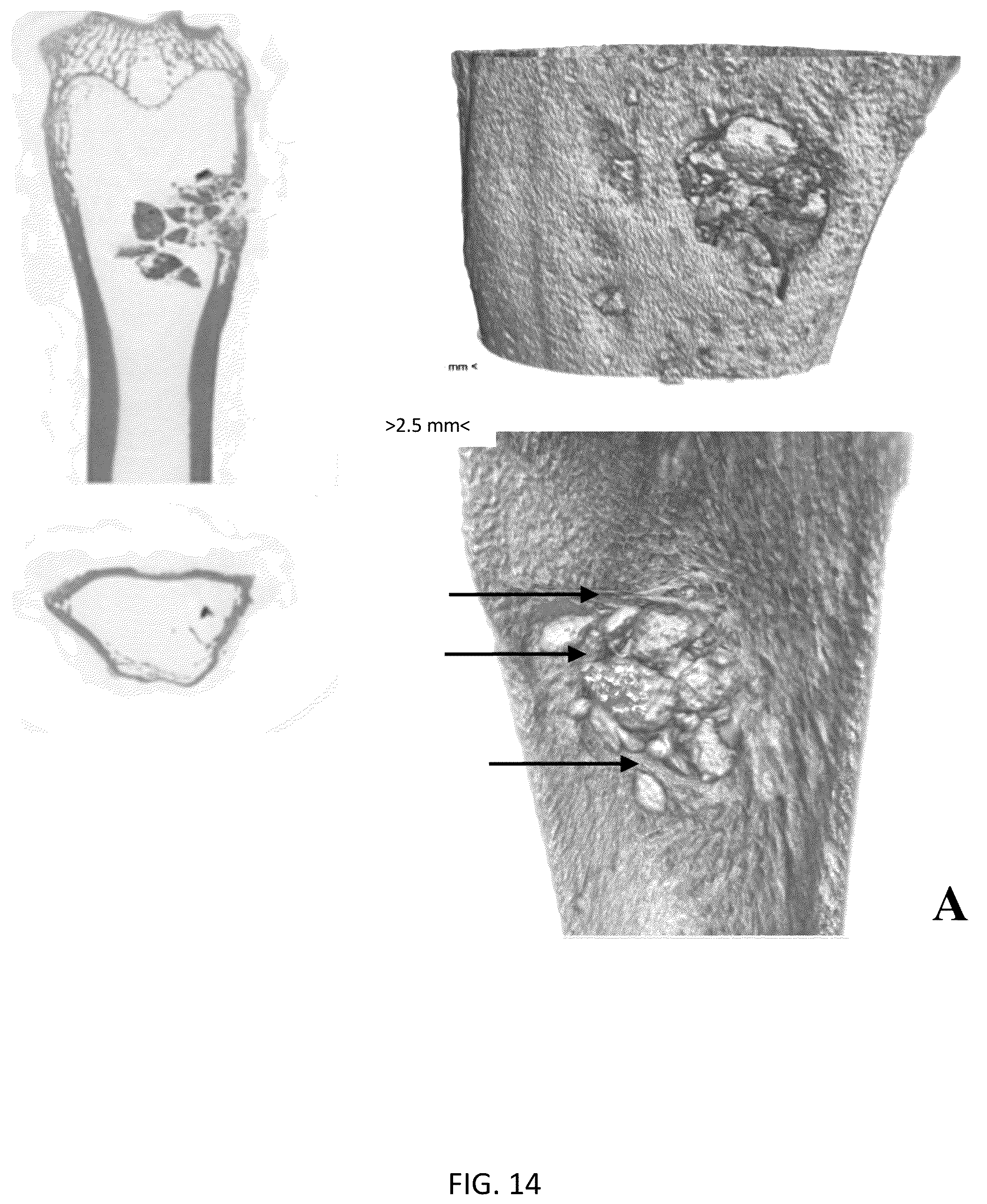 Patent US12318504 Figure 12 – Method for manufacturing a calcified tissue substitute