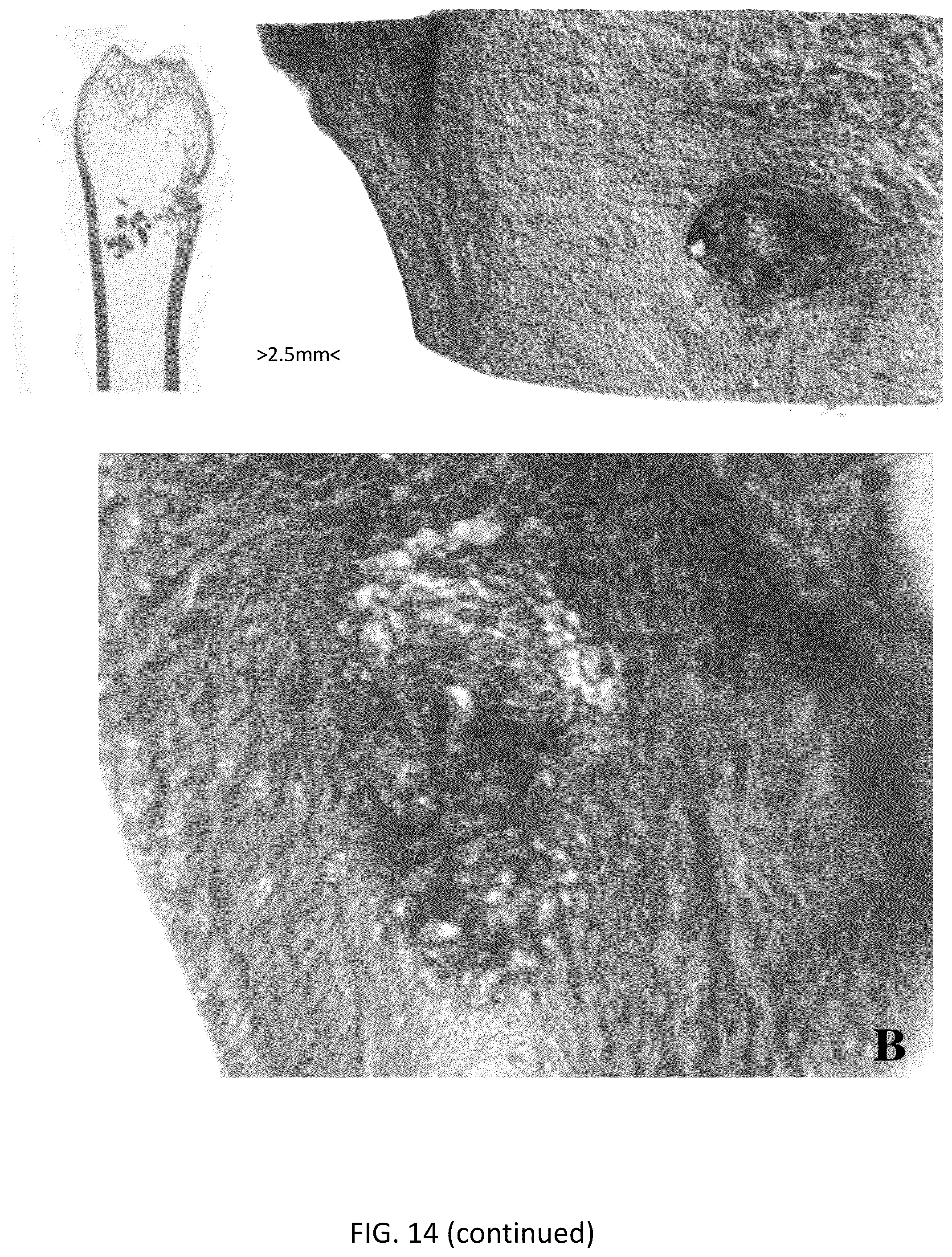 Patent US12318504 Figure 13 – Method for manufacturing a calcified tissue substitute