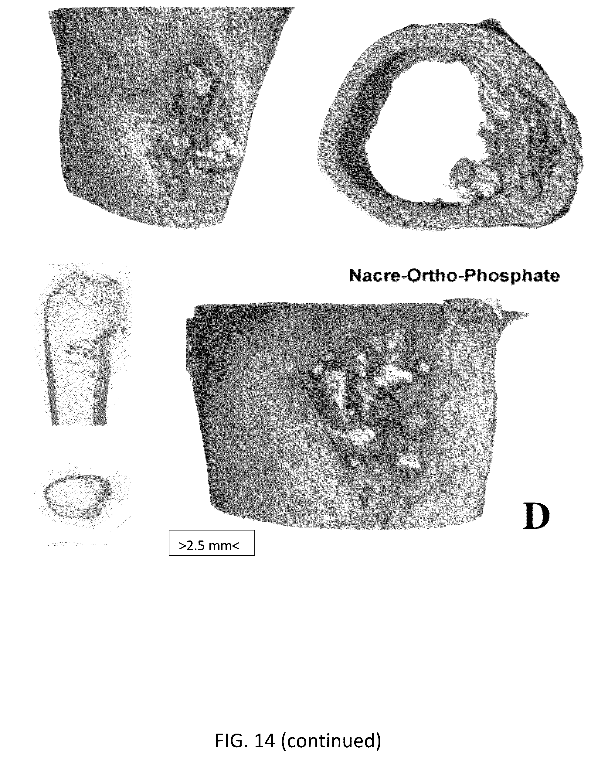 Patent US12318504 Figure 15 – Method for manufacturing a calcified tissue substitute