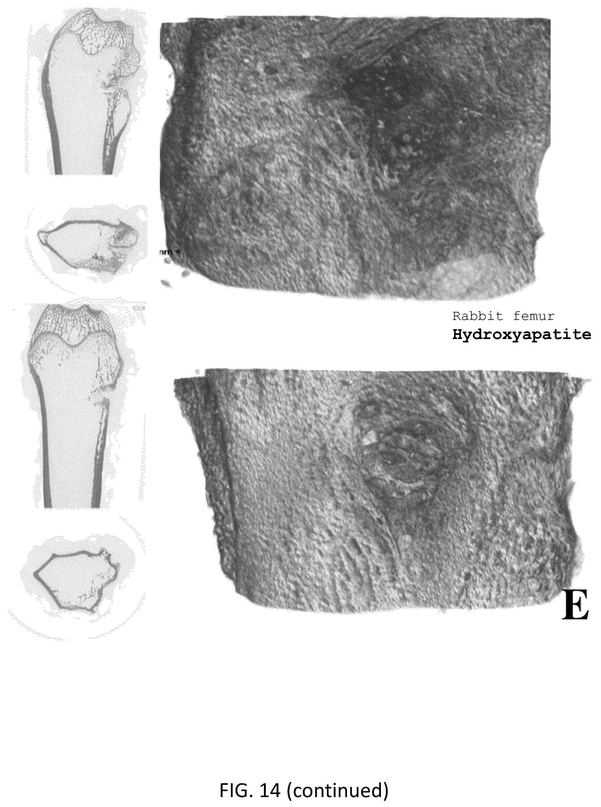 Patent US12318504 Figure 16 – Method for manufacturing a calcified tissue substitute