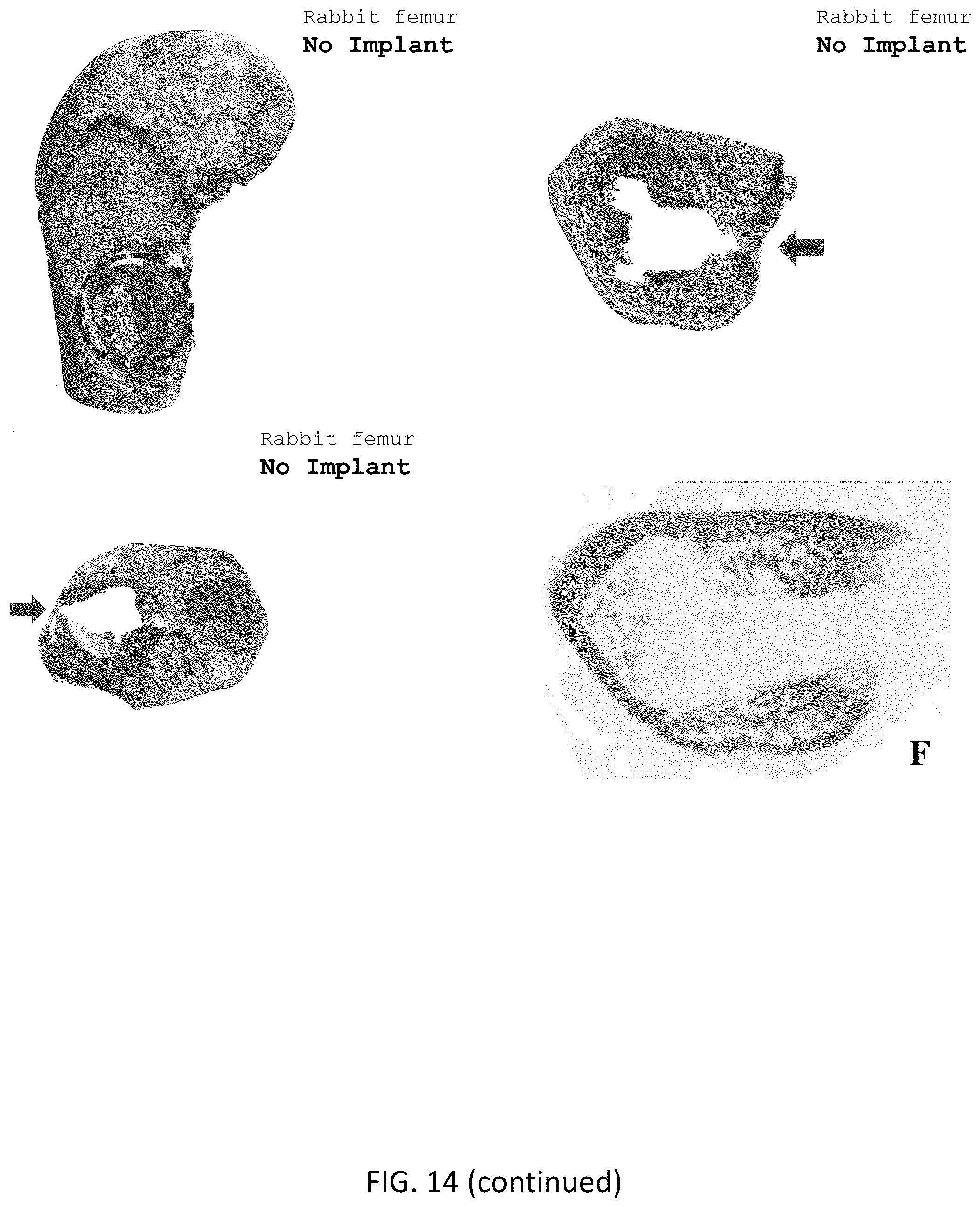 Patent US12318504 Figure 17 – Method for manufacturing a calcified tissue substitute