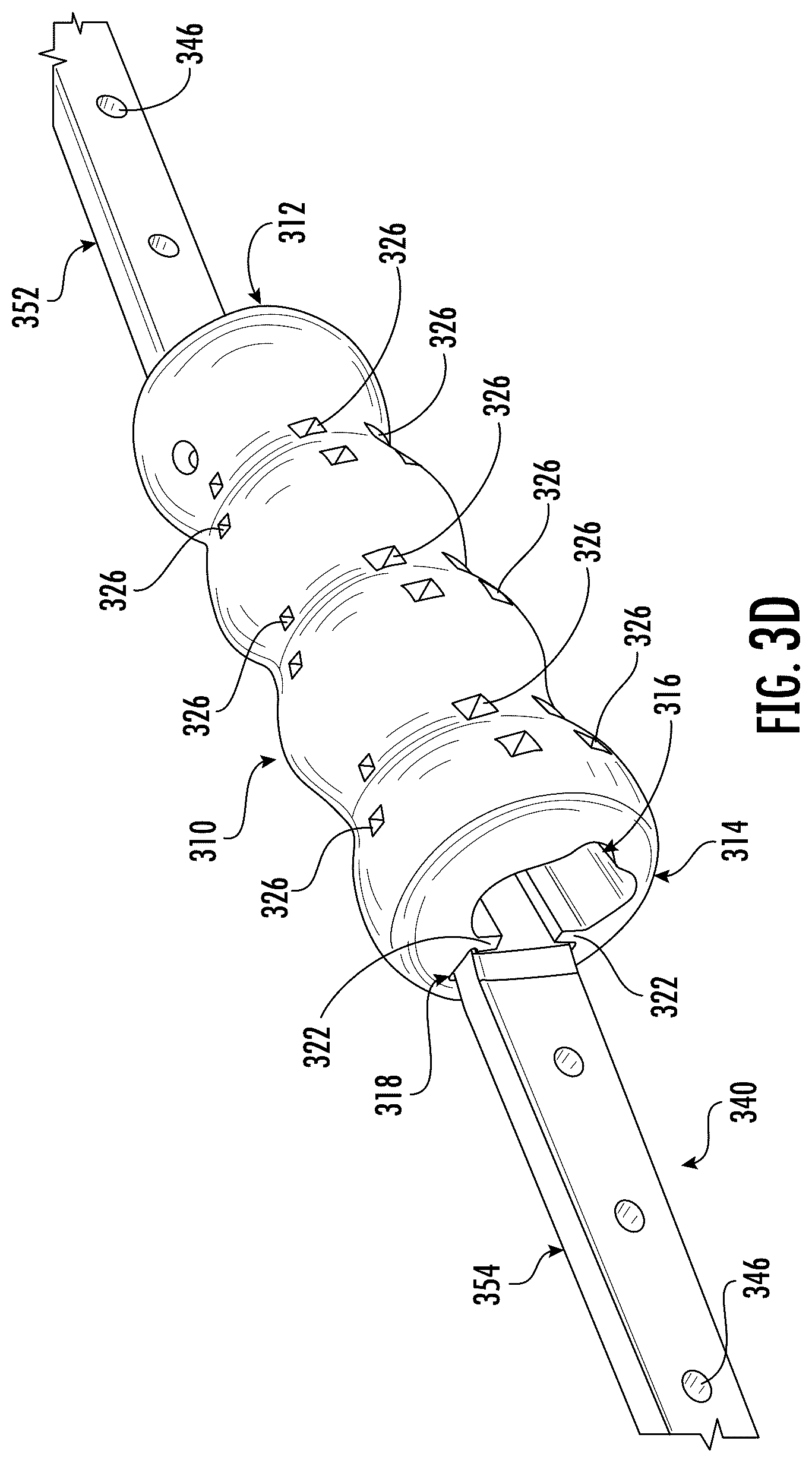 Patent US12318510 Figure 7 – Methods and devices for improving bone healing