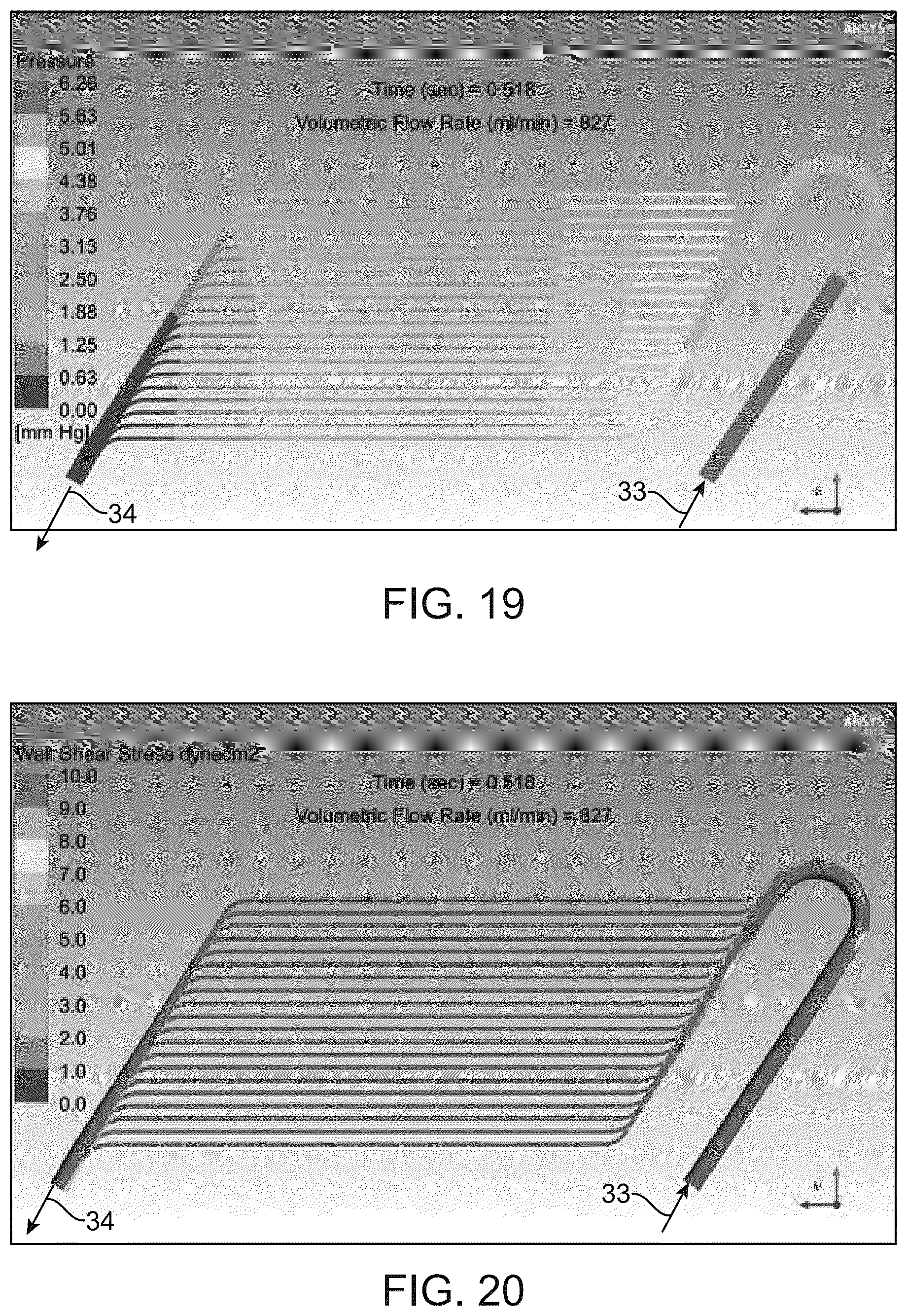 Patent US12318522 Figure 11 – Hemofilter for in vivo blood filtration