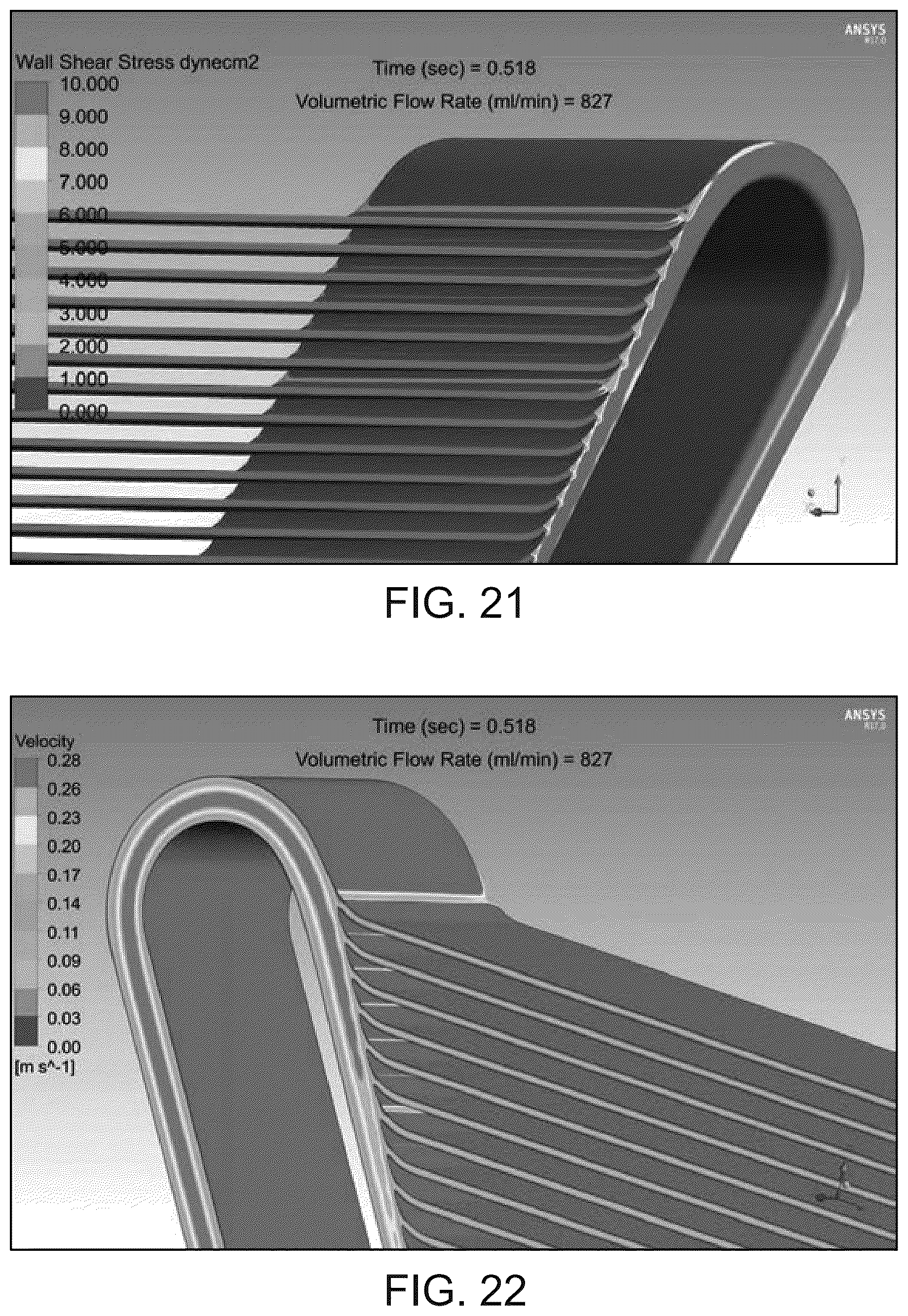 Patent US12318522 Figure 12 – Hemofilter for in vivo blood filtration