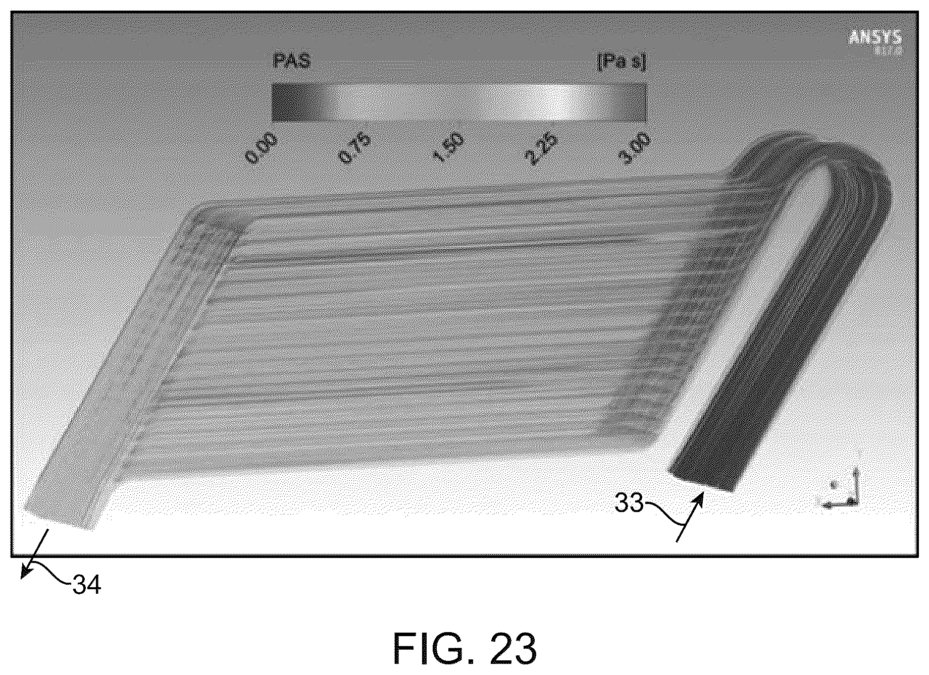 Patent US12318522 Figure 13 – Hemofilter for in vivo blood filtration