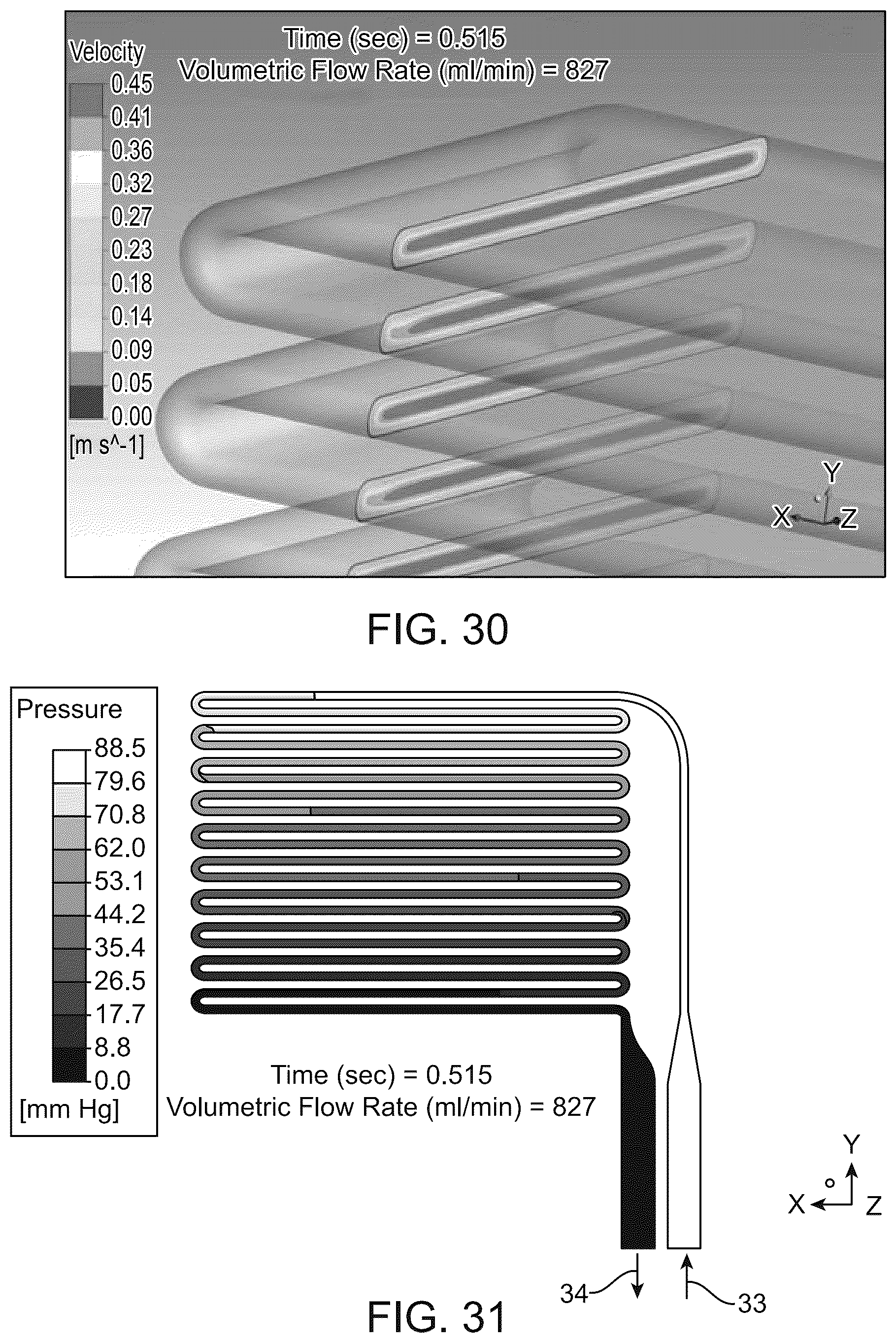 Patent US12318522 Figure 17 – Hemofilter for in vivo blood filtration