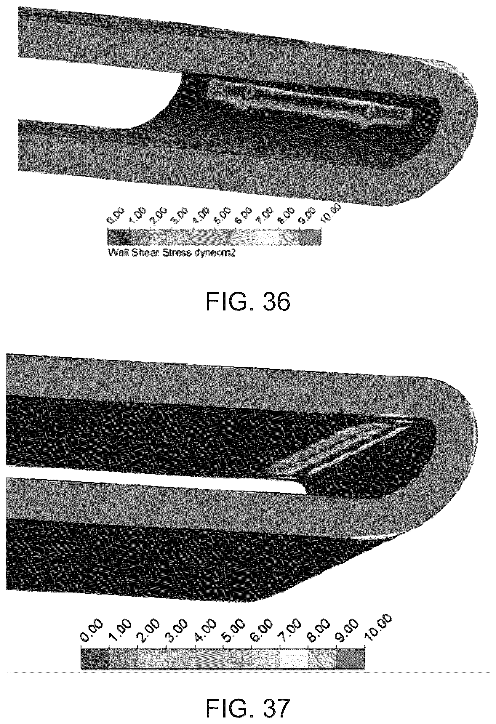 Patent US12318522 Figure 20 – Hemofilter for in vivo blood filtration