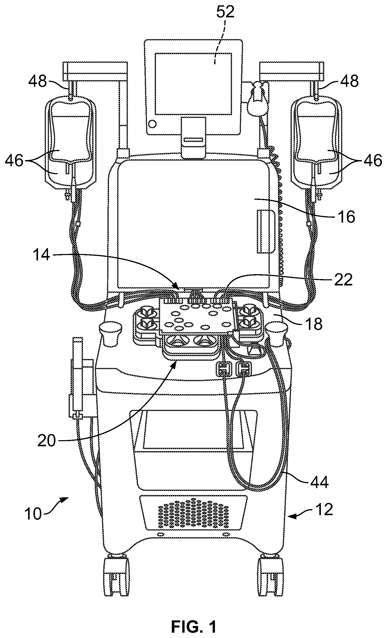 Patent US12318527 Figure 1 – Control of fluid flow during priming of a fluid flow circuit