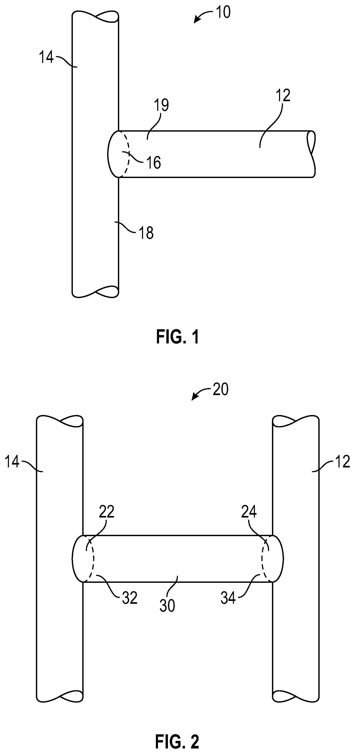 Patent US12318528 Figure 1 – Variable orifice fistula graft