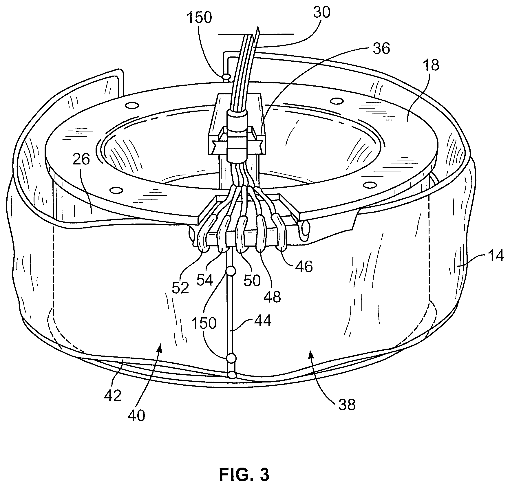 Patent US12318530 Figure 3 – Systems and methods for performing extracorporeal photopheresis