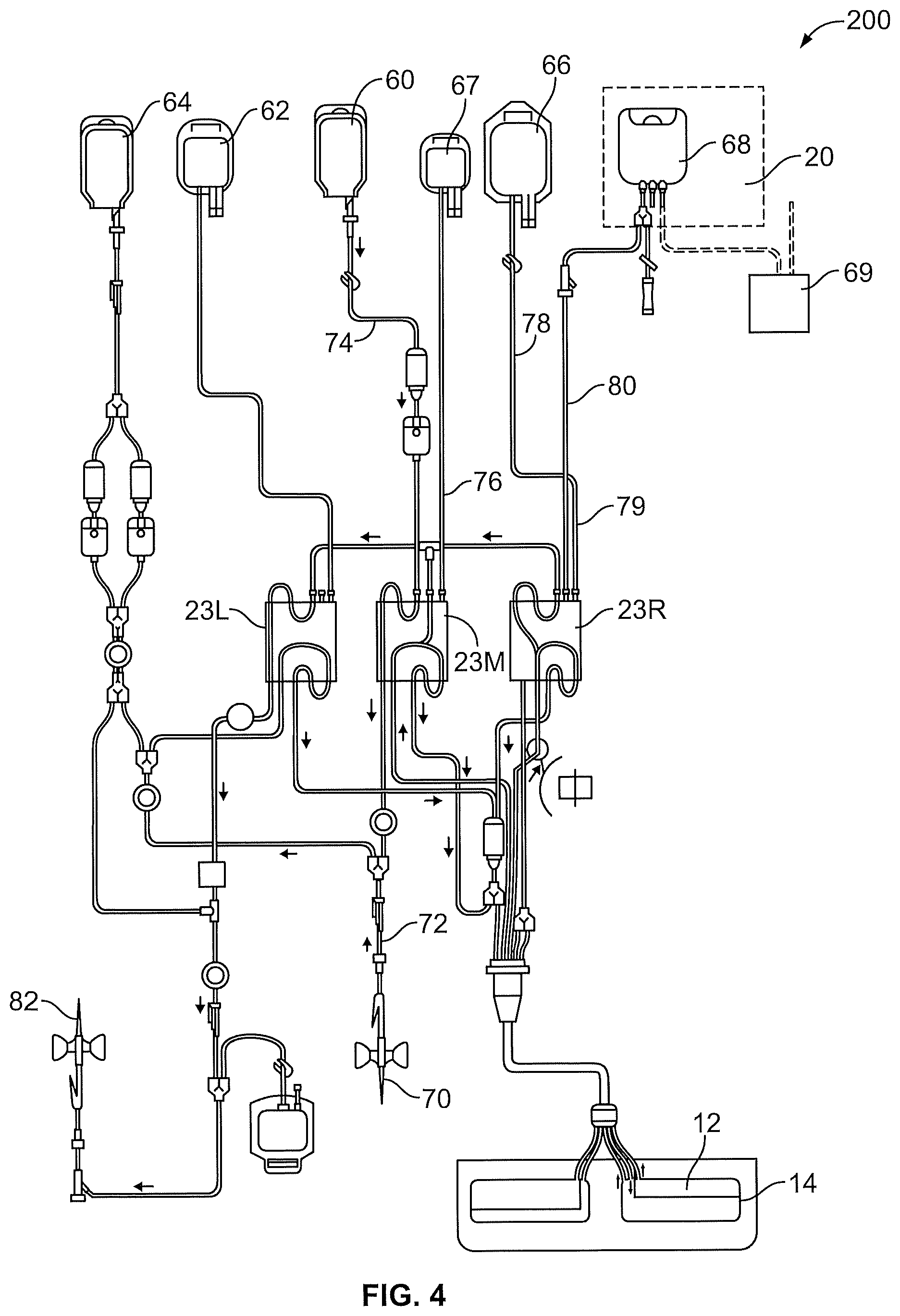 Patent US12318530 Figure 4 – Systems and methods for performing extracorporeal photopheresis