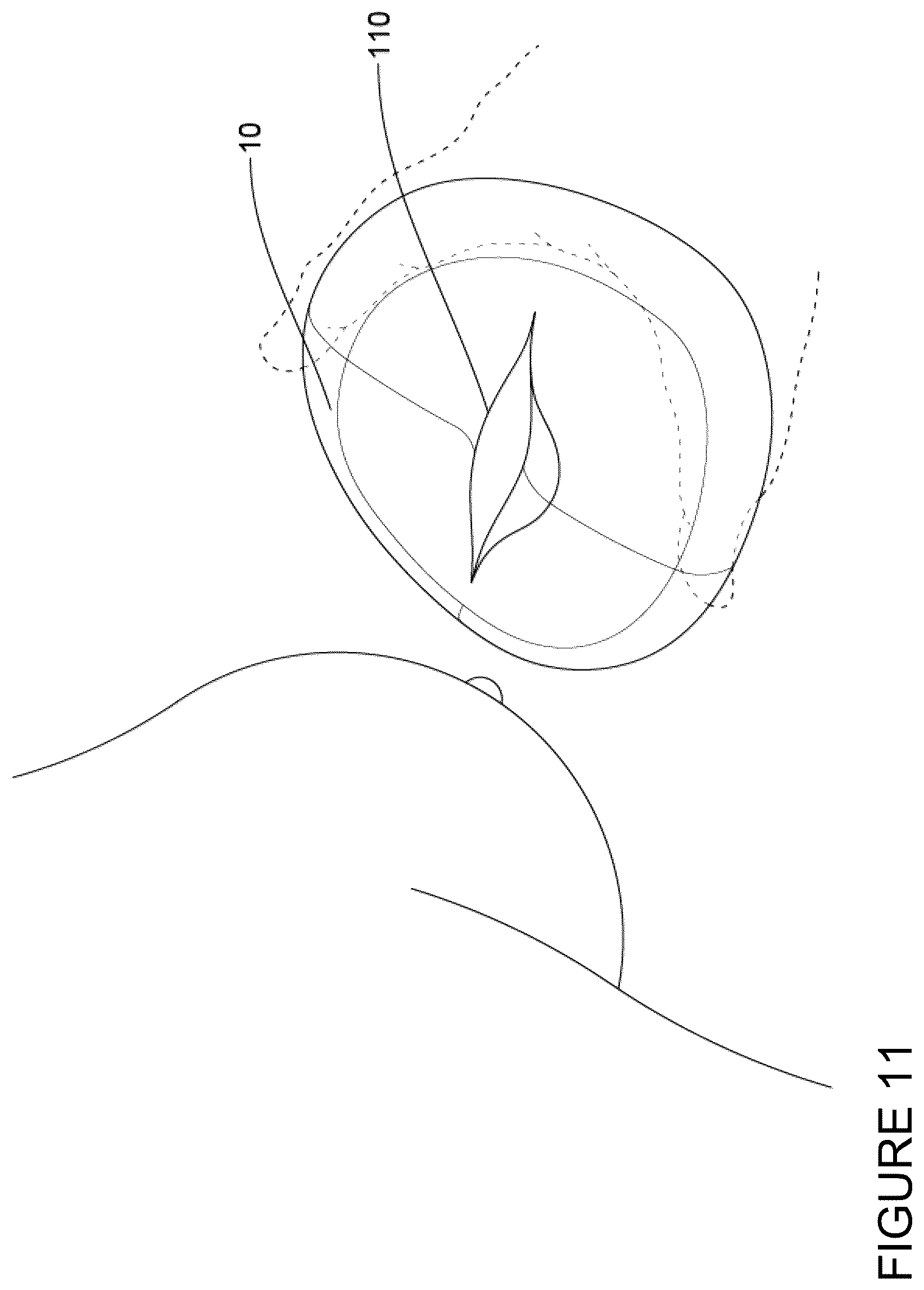 Patent US12318531 Figure 11 – Passive milk collection vessel
