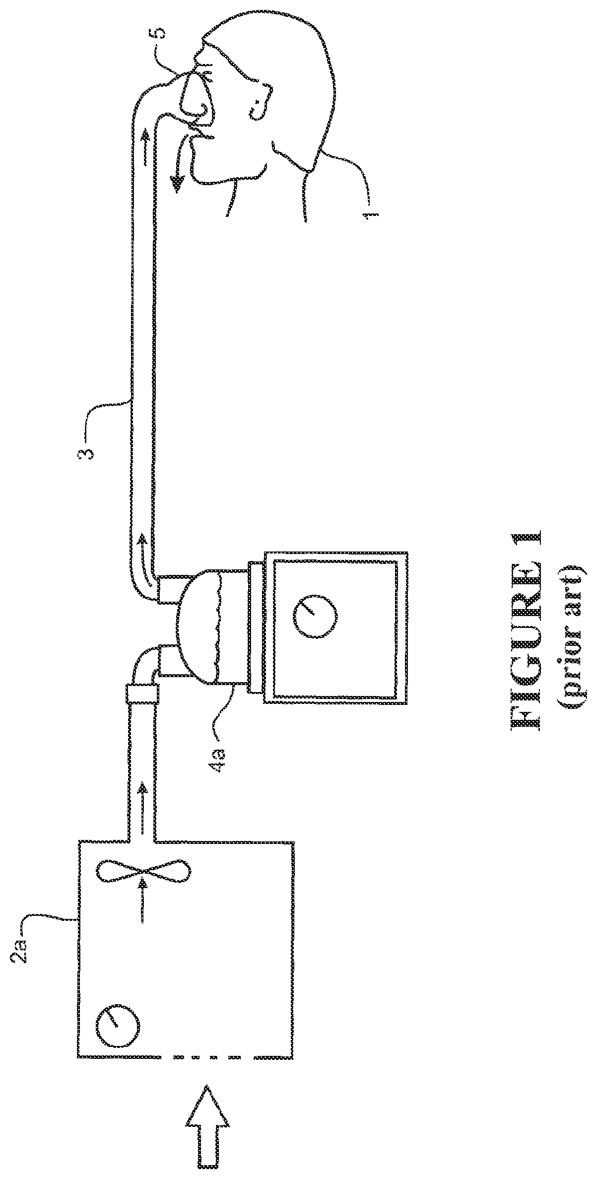 Patent US12318538 Figure 1 – Impeller and motor assembly