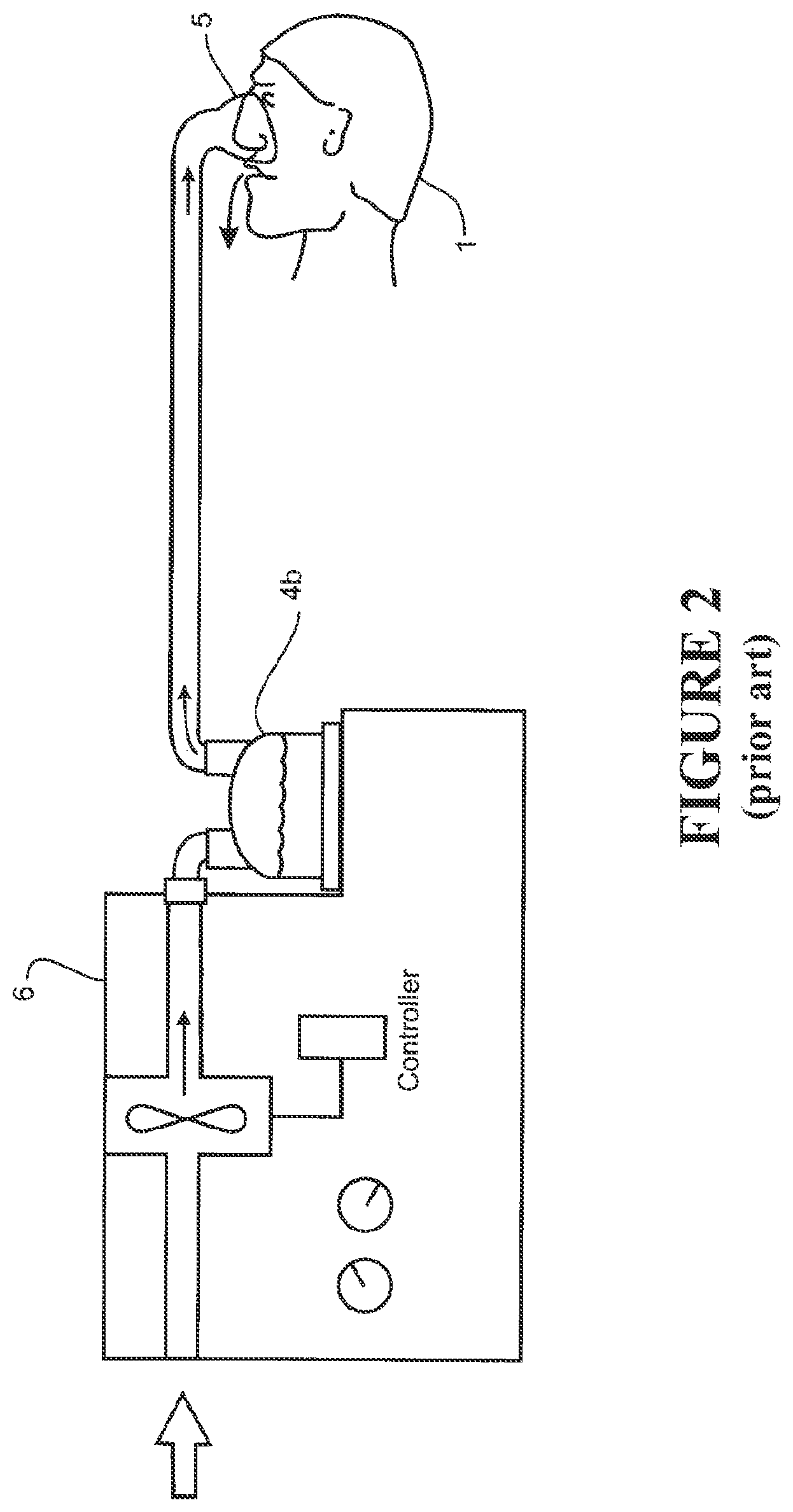Patent US12318538 Figure 2 – Impeller and motor assembly