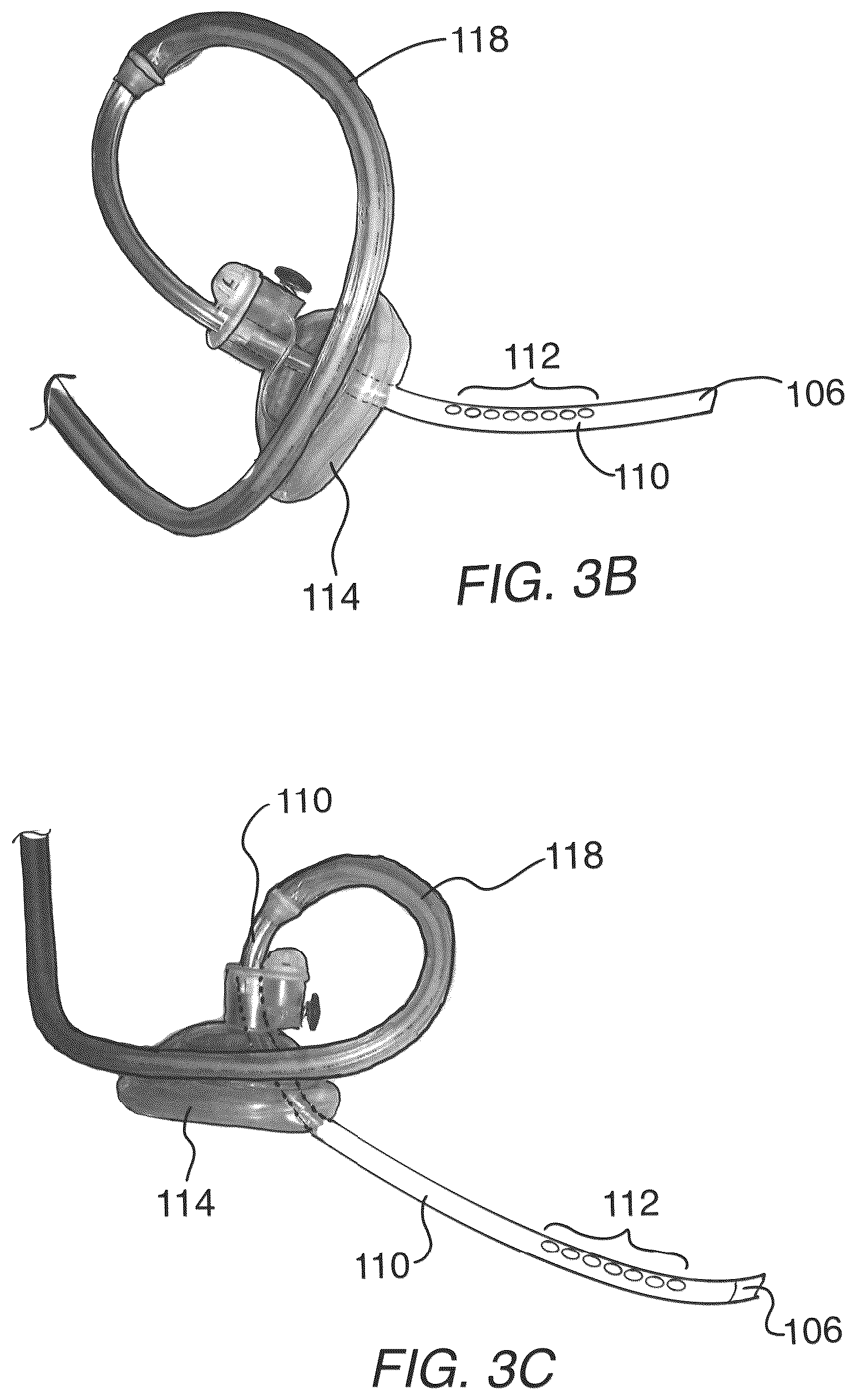 Patent US12318539 Figure 4 – Apparatus and method for improved assisted ventilation