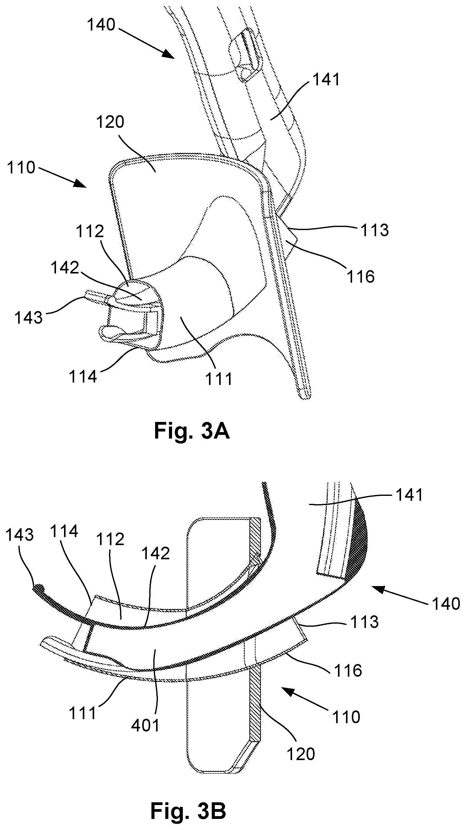 Patent US12318541 Figure 7 – Shielded intubation guide and method