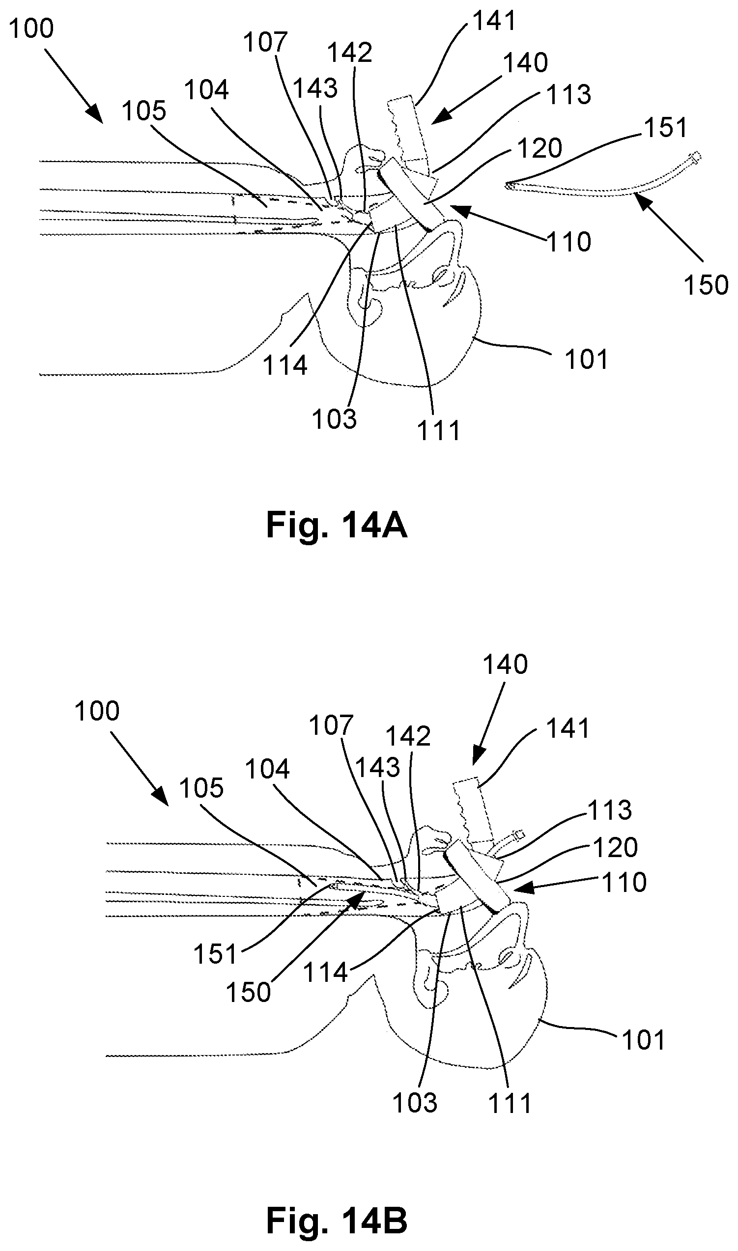 Patent US12318541 Figure 18 – Shielded intubation guide and method