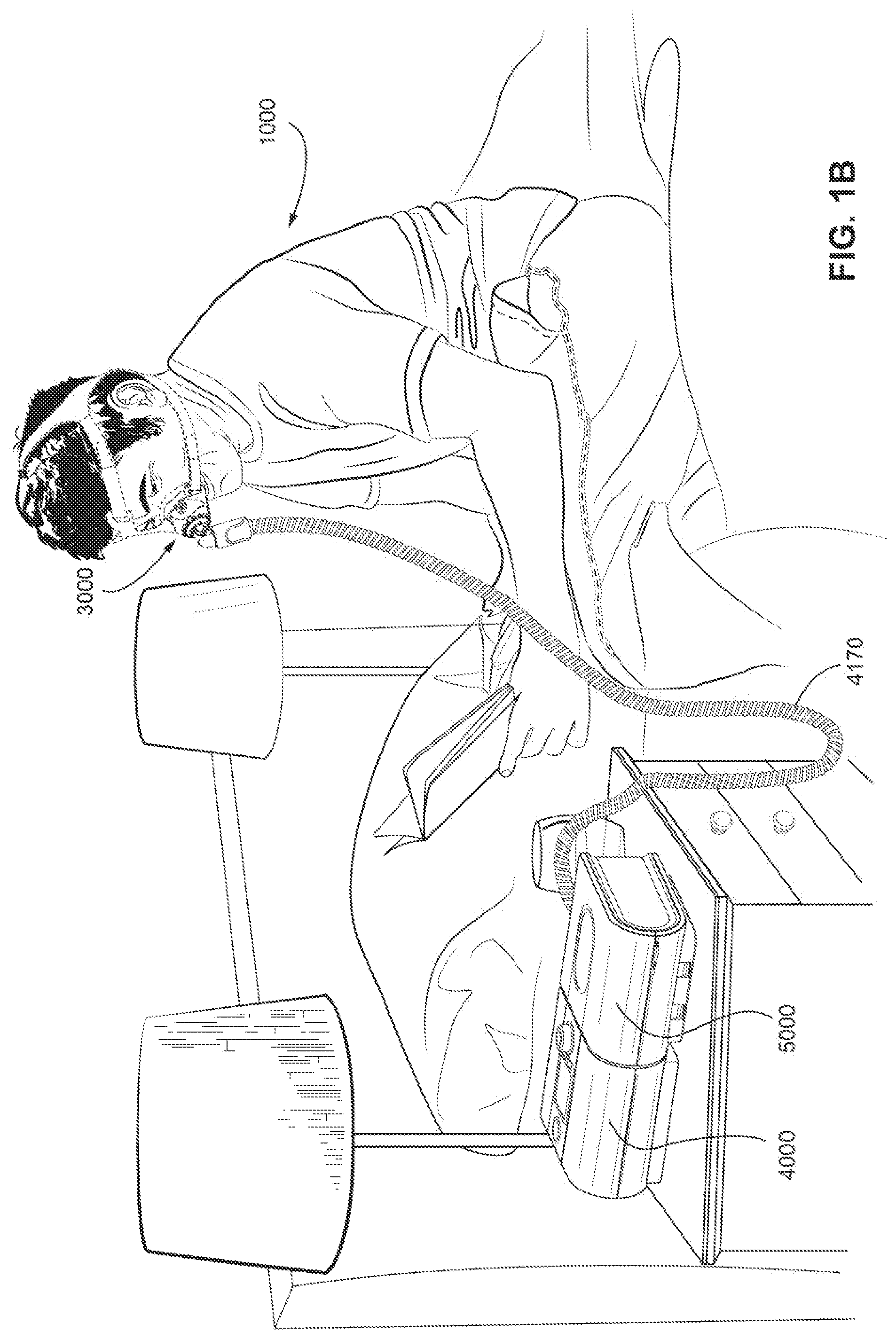 Patent US12318544 Figure 2 – Elbow assembly