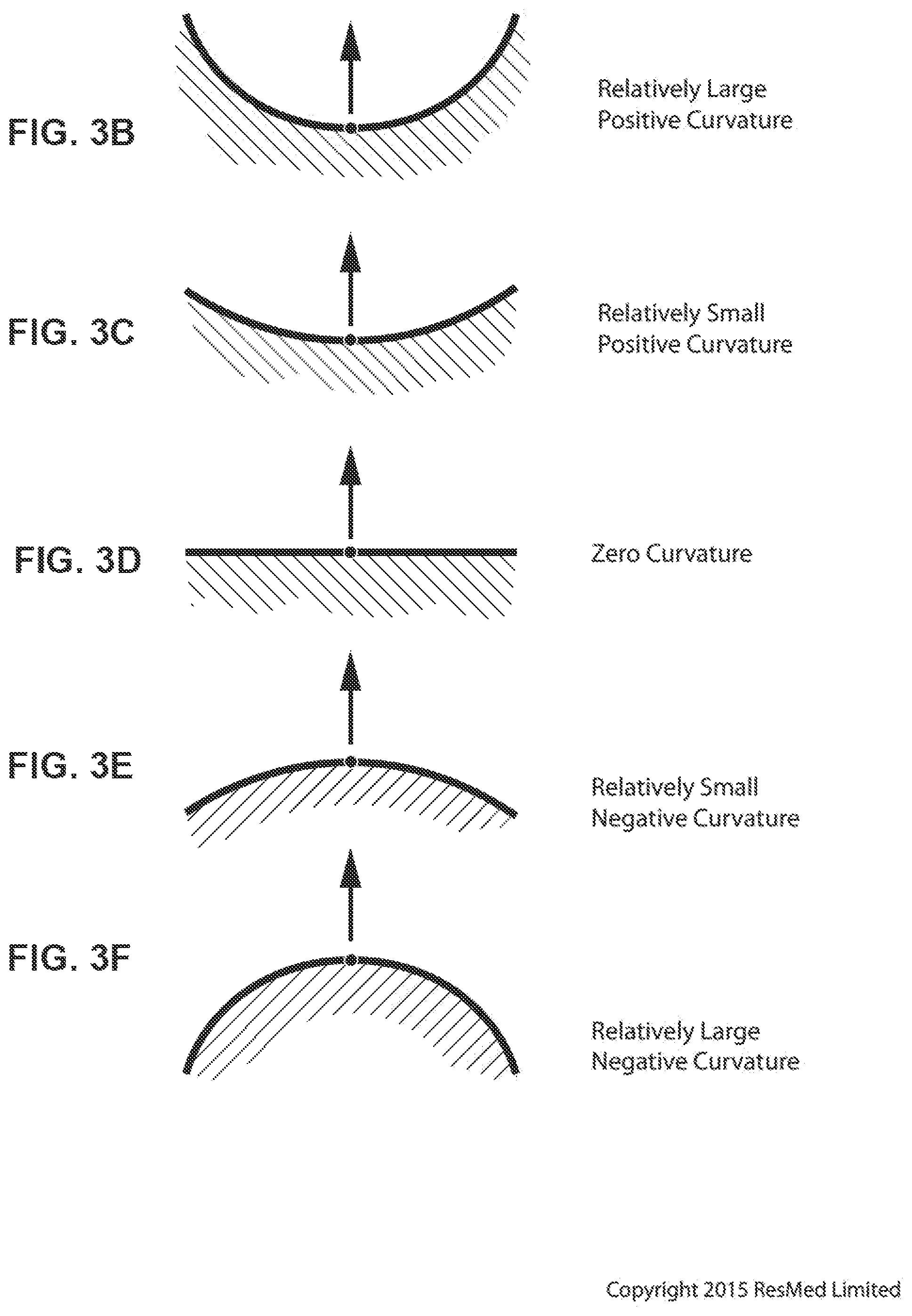 Patent US12318544 Figure 14 – Elbow assembly