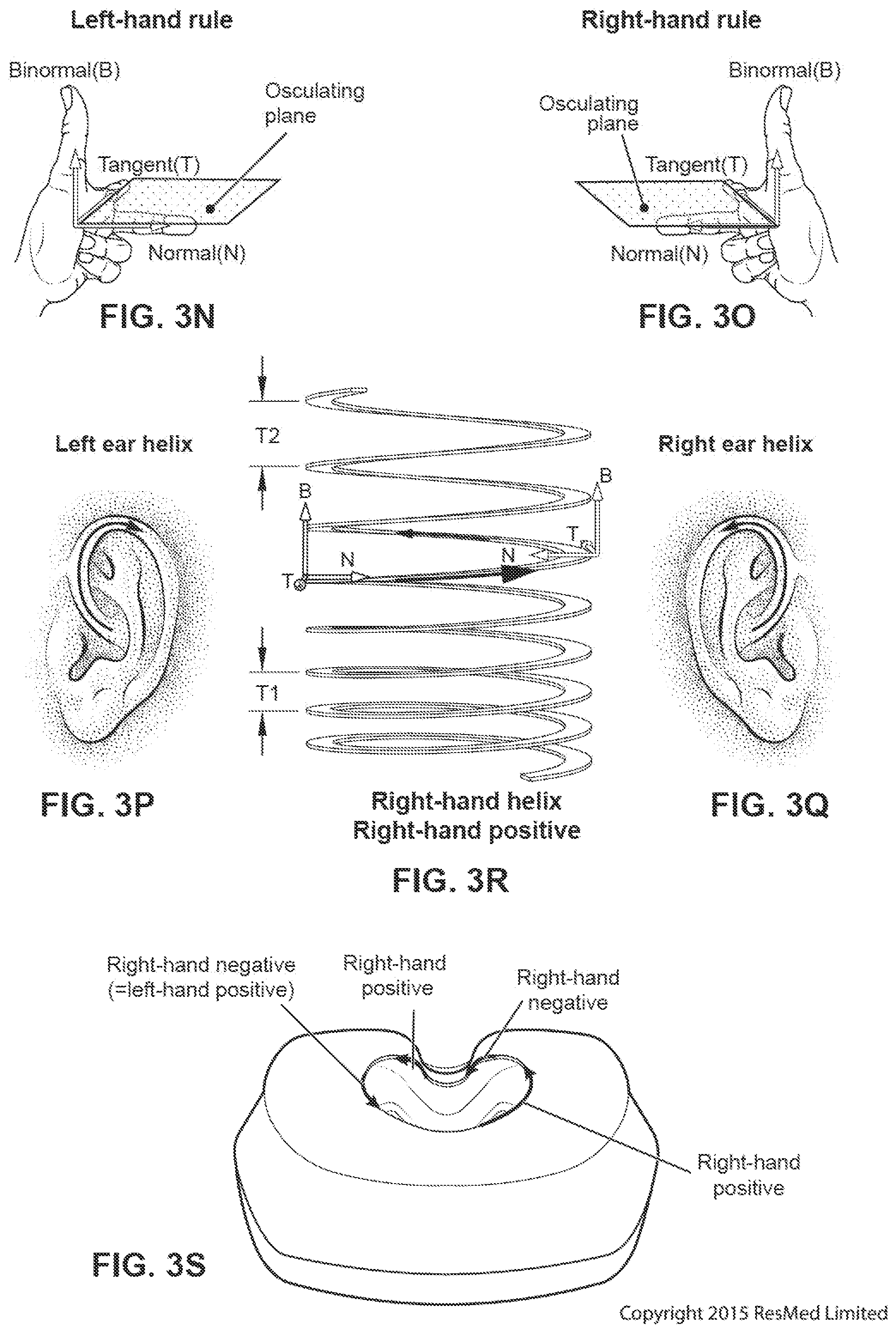Patent US12318544 Figure 17 – Elbow assembly